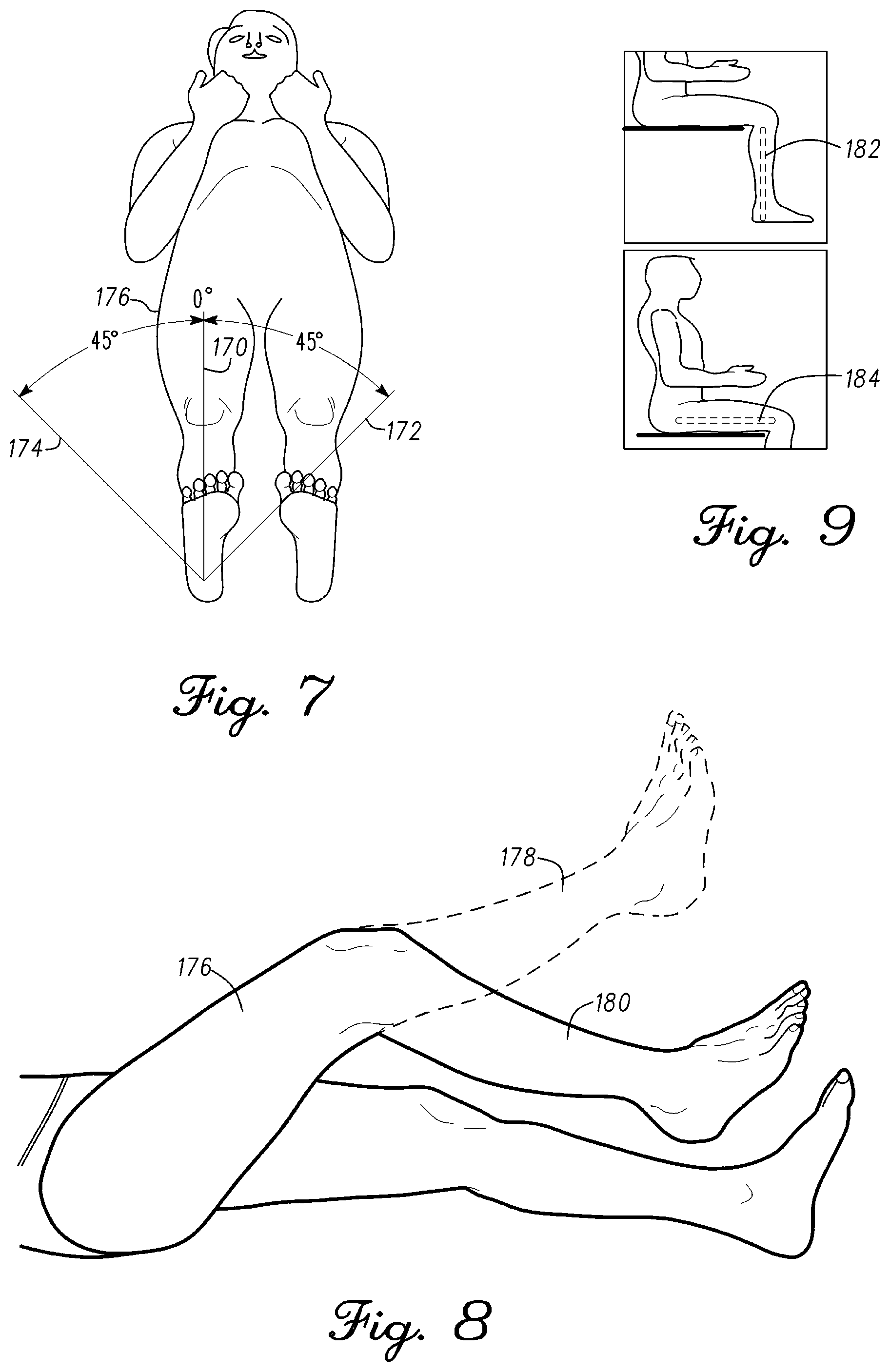Patent US12097130 Figure 6 – Orthopedic leg alignment system and method