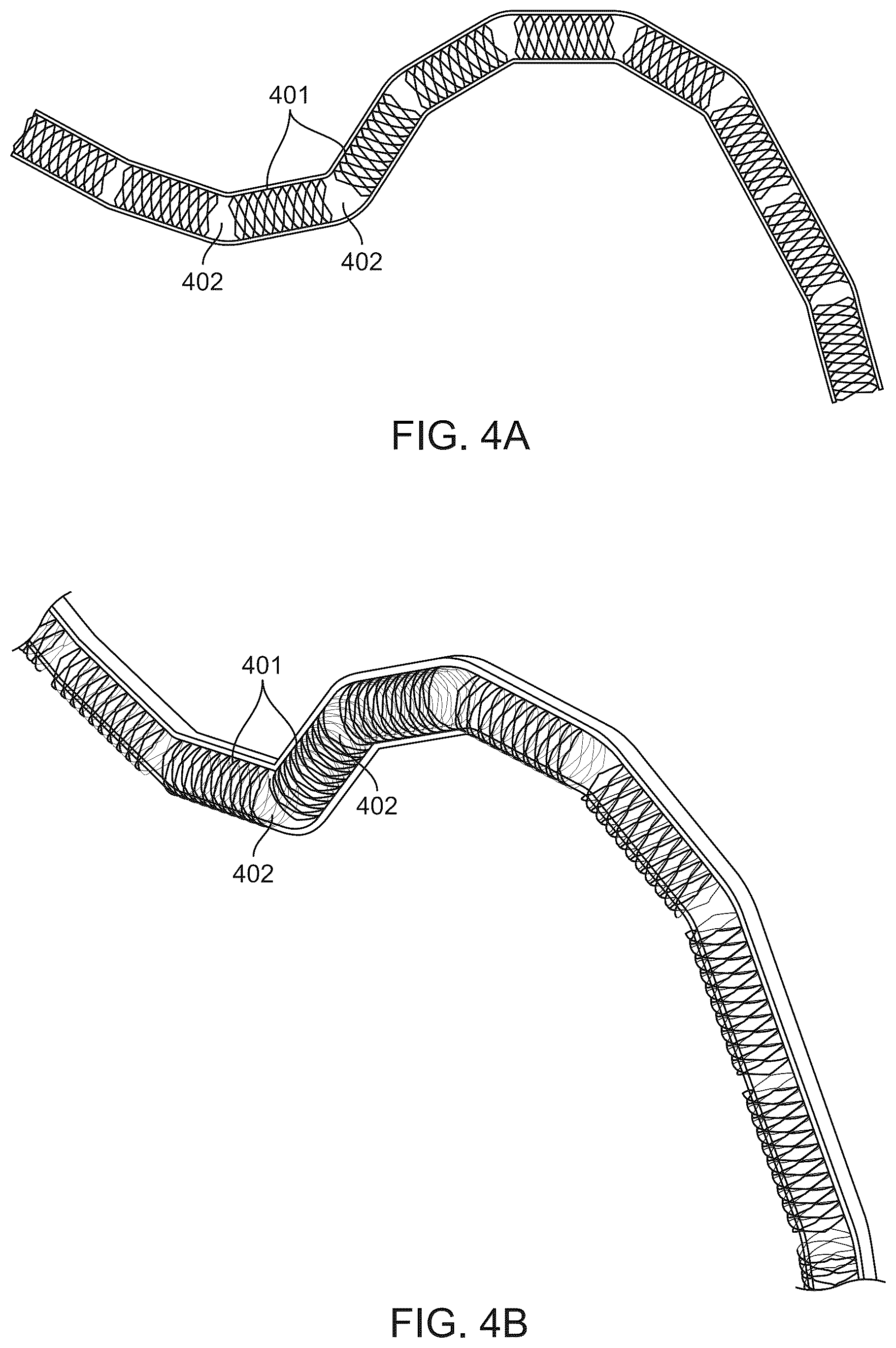 Patent US12097134 Figure 4 – Absorbable intravascular devices that provide a decrease in radial rigidity of the vessel over time