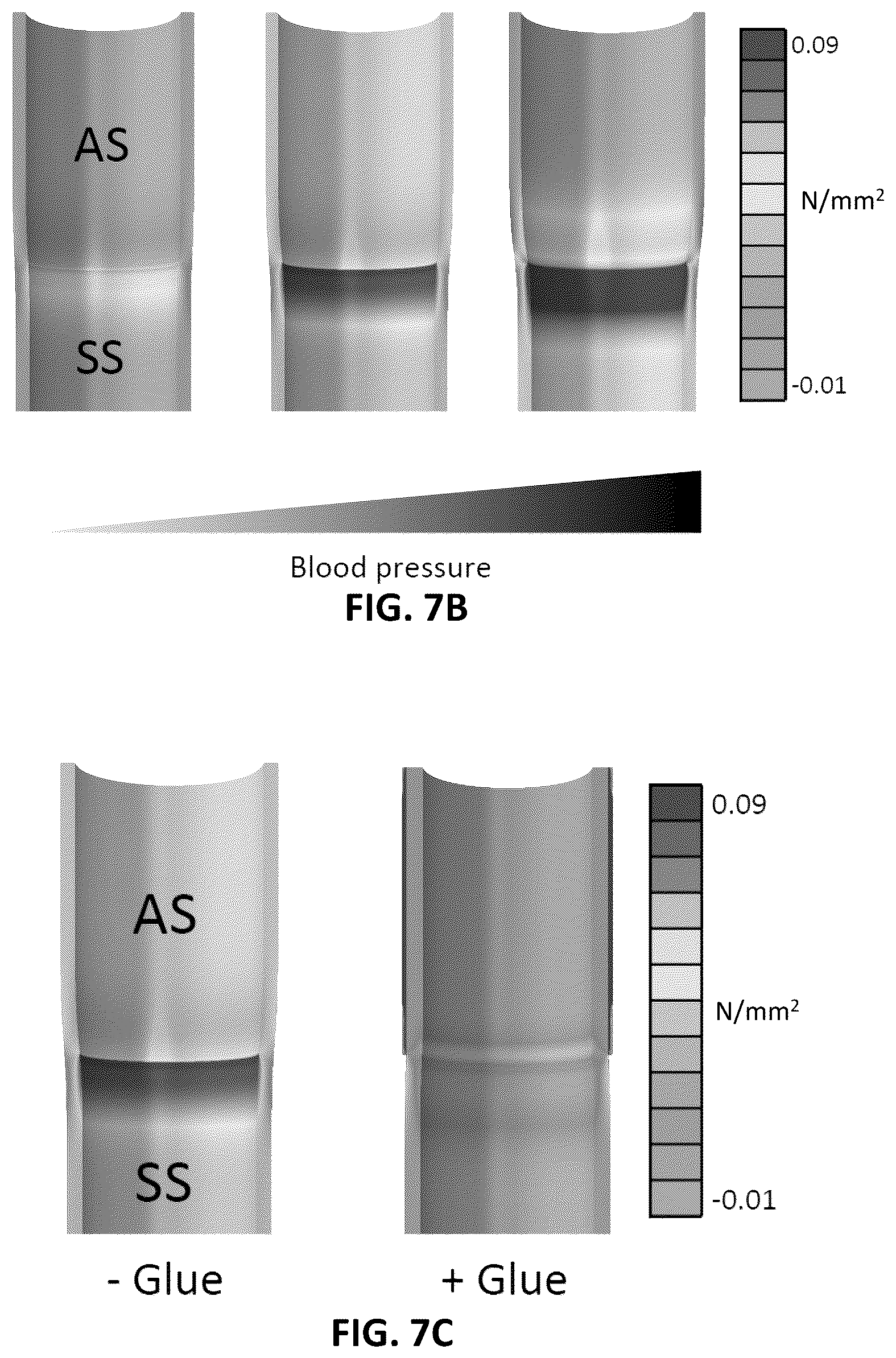 Patent US12097135 Figure 5 – Methods, devices, and compositions for treating vascular aneurysms
