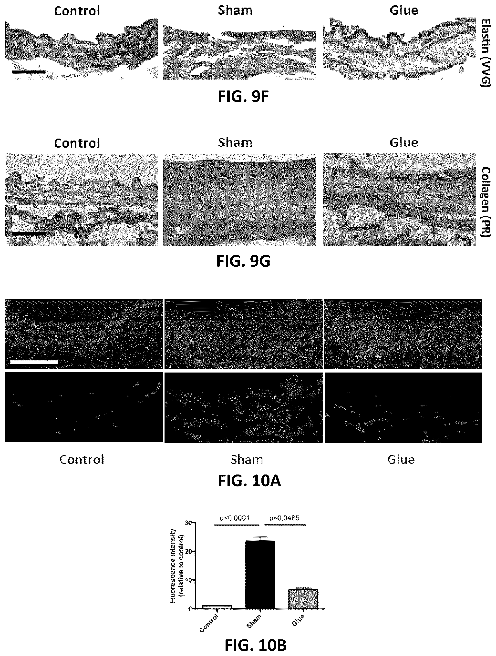 Patent US12097135 Figure 8 – Methods, devices, and compositions for treating vascular aneurysms