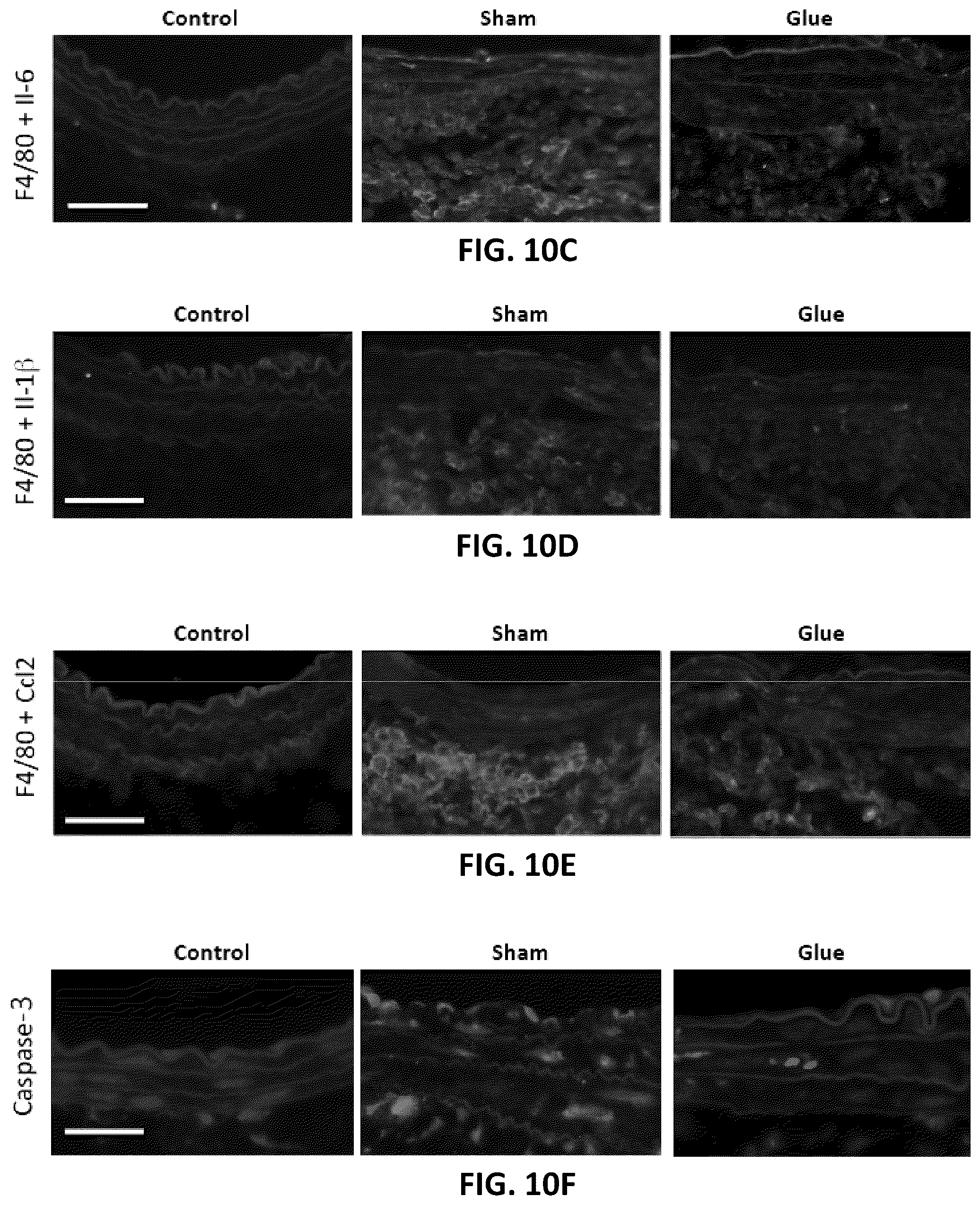 Patent US12097135 Figure 9 – Methods, devices, and compositions for treating vascular aneurysms
