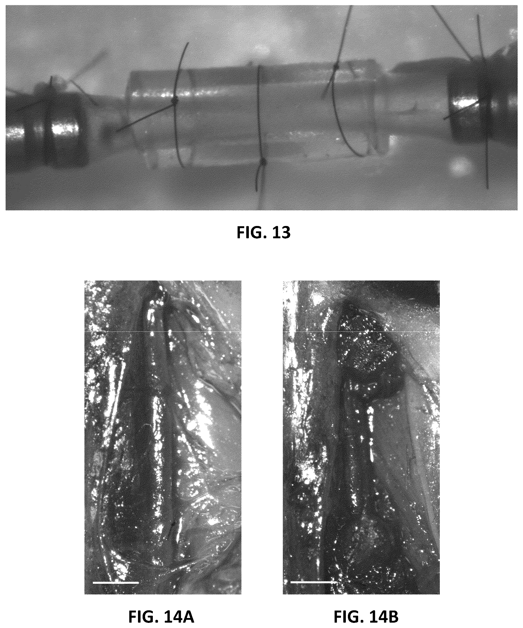 Patent US12097135 Figure 13 – Methods, devices, and compositions for treating vascular aneurysms