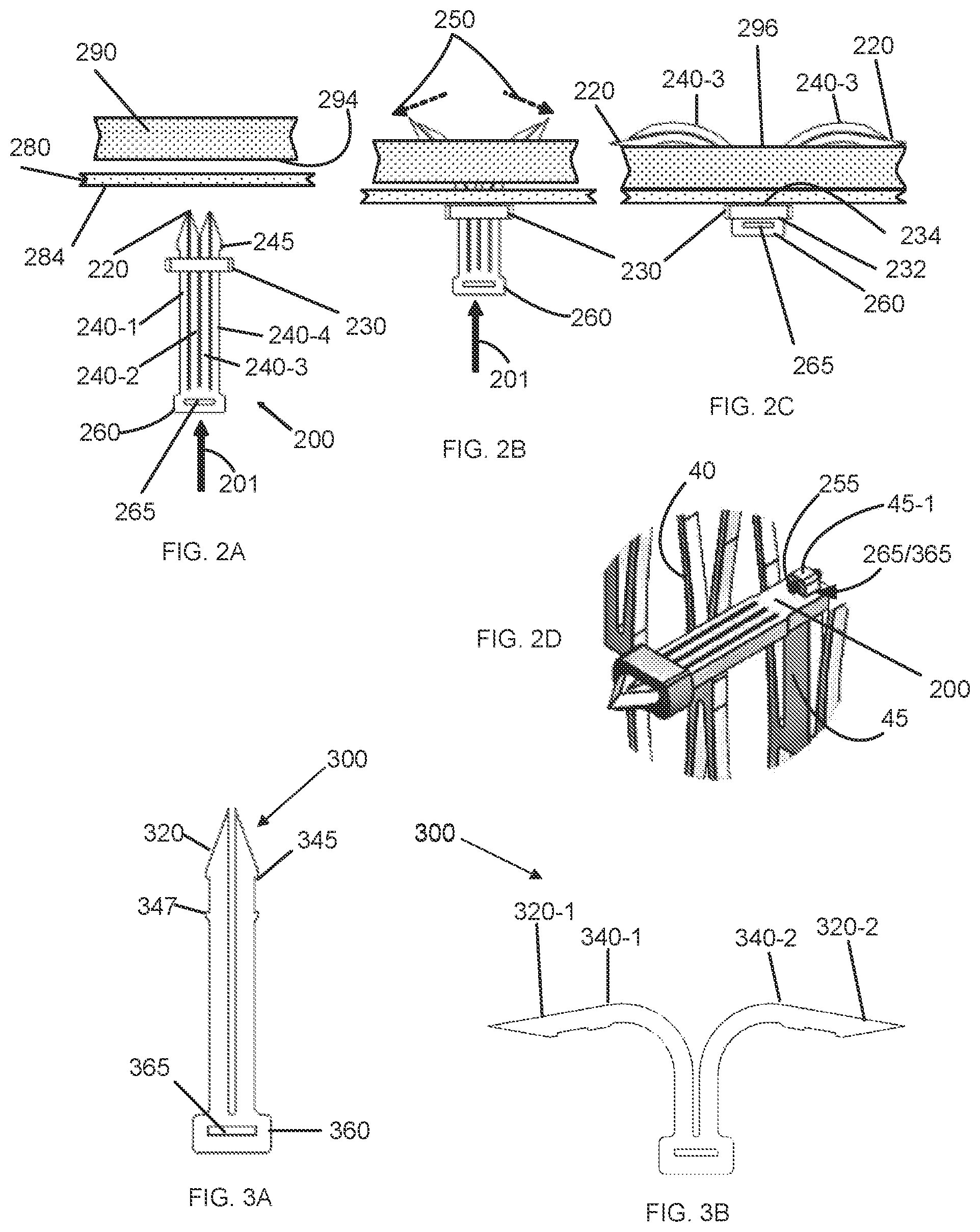 Patent US12097136 Figure 2 – Graft securing system, applicator and method