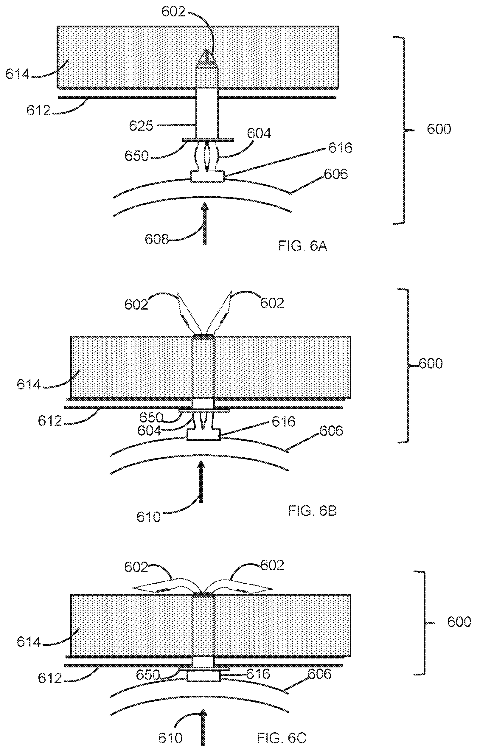Patent US12097136 Figure 5 – Graft securing system, applicator and method