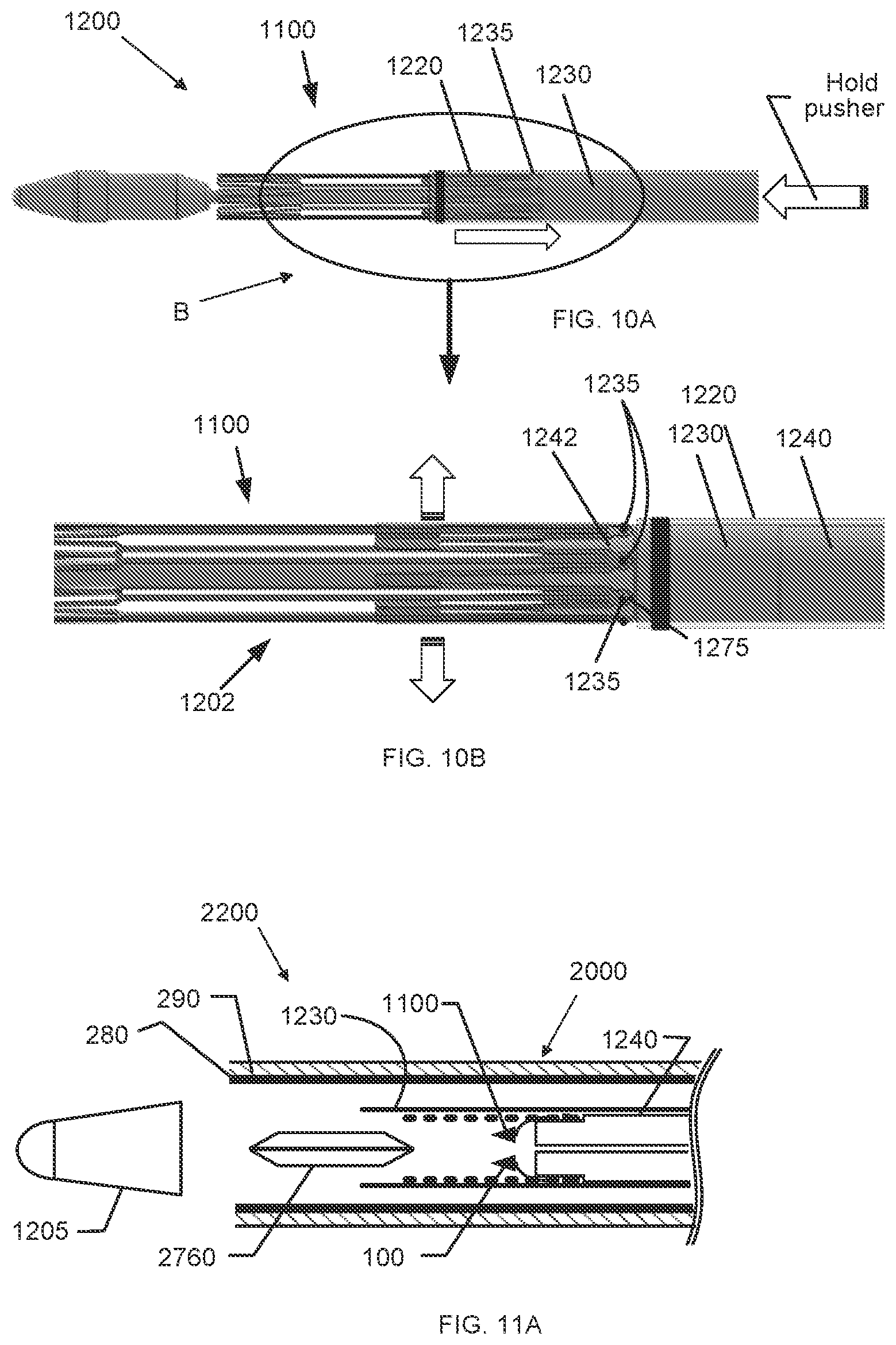 Patent US12097136 Figure 9 – Graft securing system, applicator and method