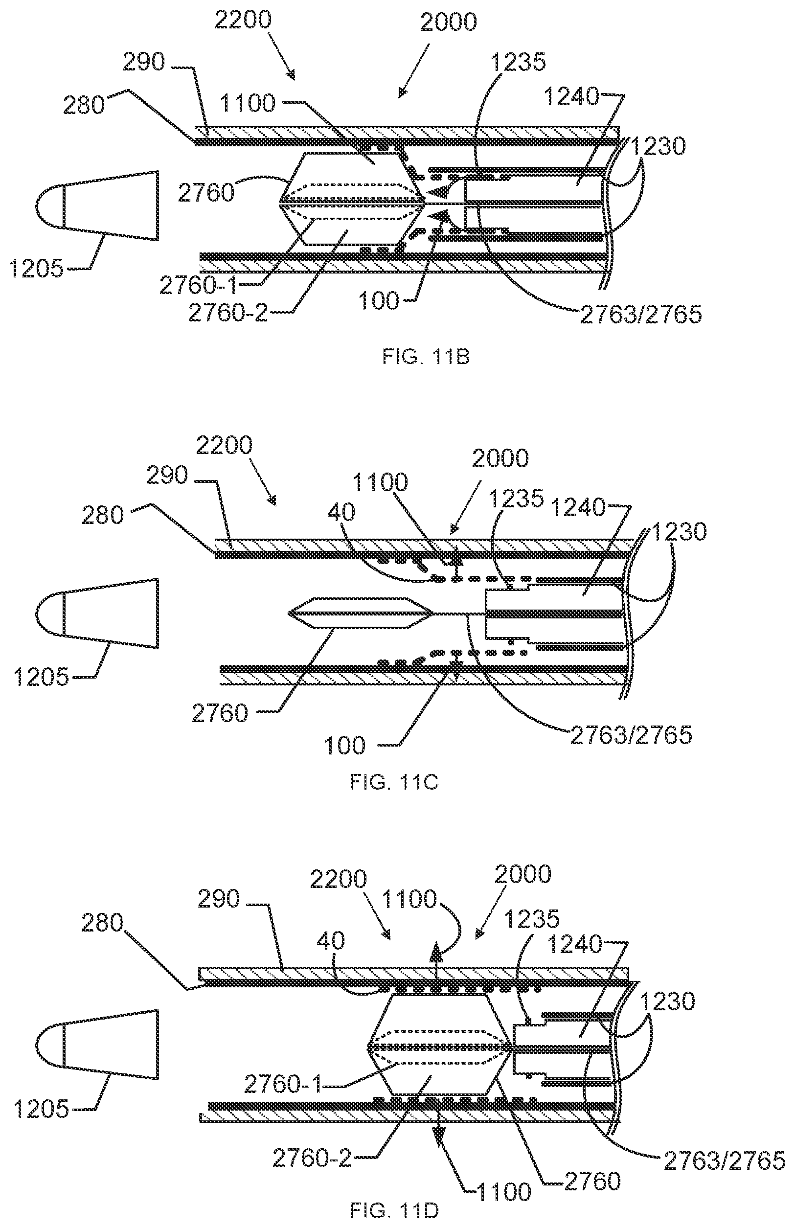 Patent US12097136 Figure 10 – Graft securing system, applicator and method