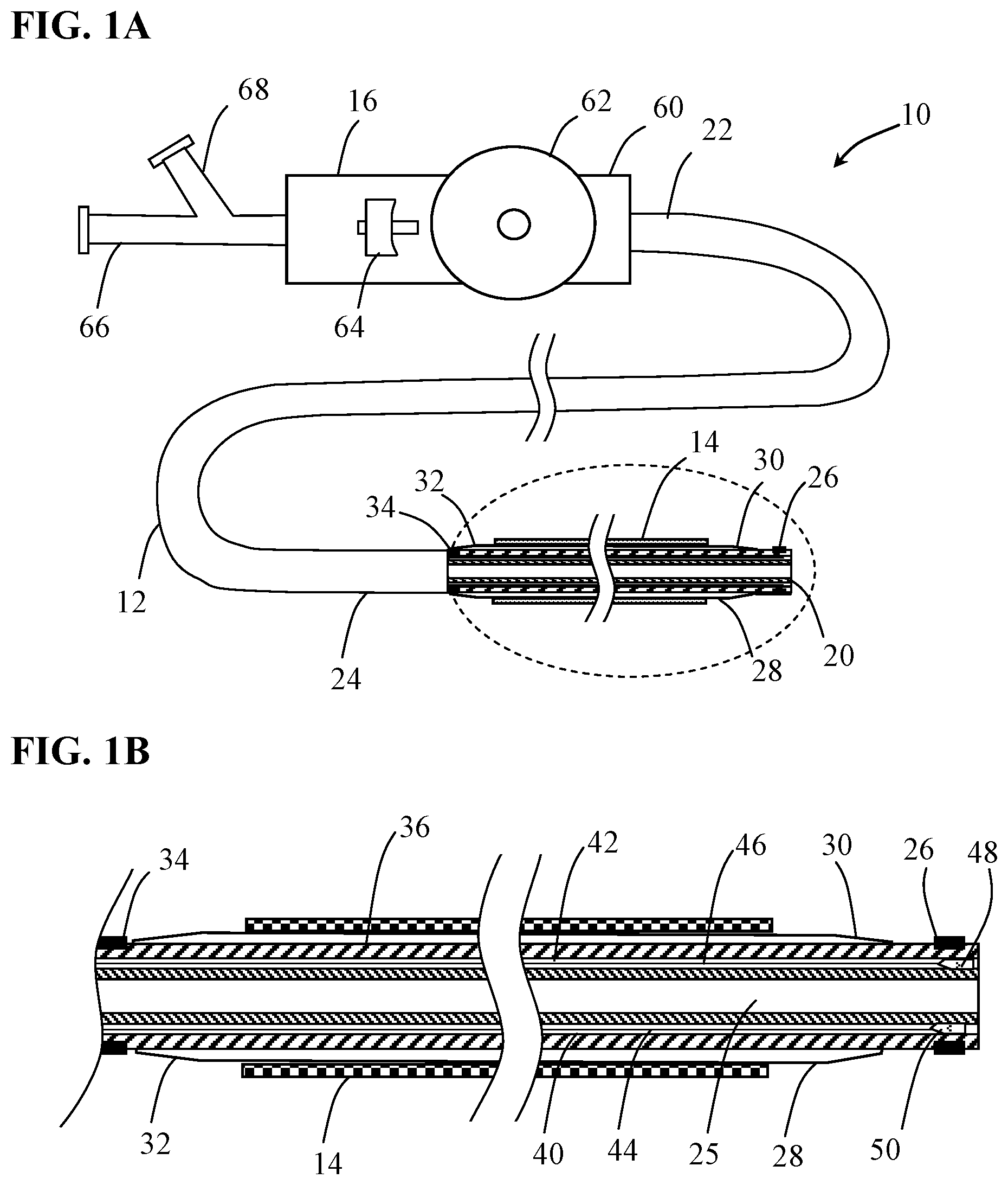 Patent US12097137 Figure 1 – Systems and methods for intravascular procedures