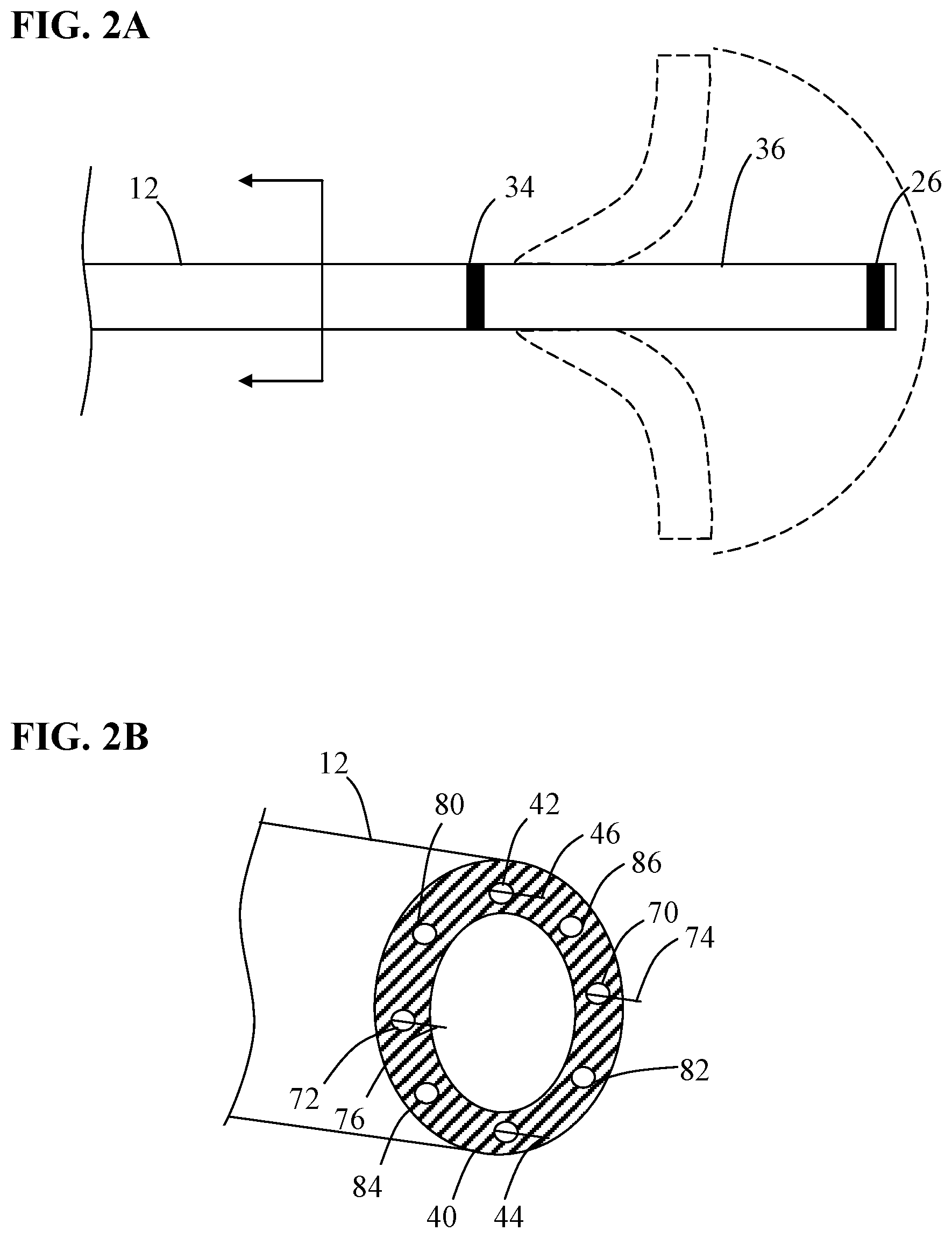 Patent US12097137 Figure 2 – Systems and methods for intravascular procedures