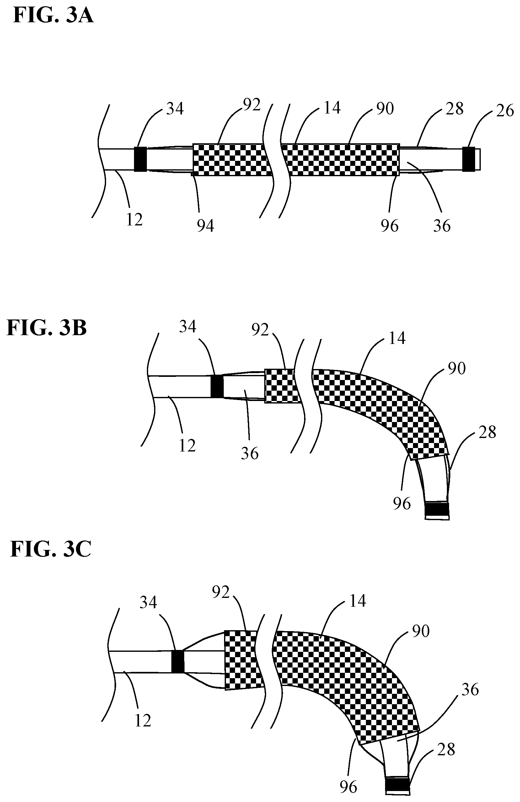 Patent US12097137 Figure 3 – Systems and methods for intravascular procedures