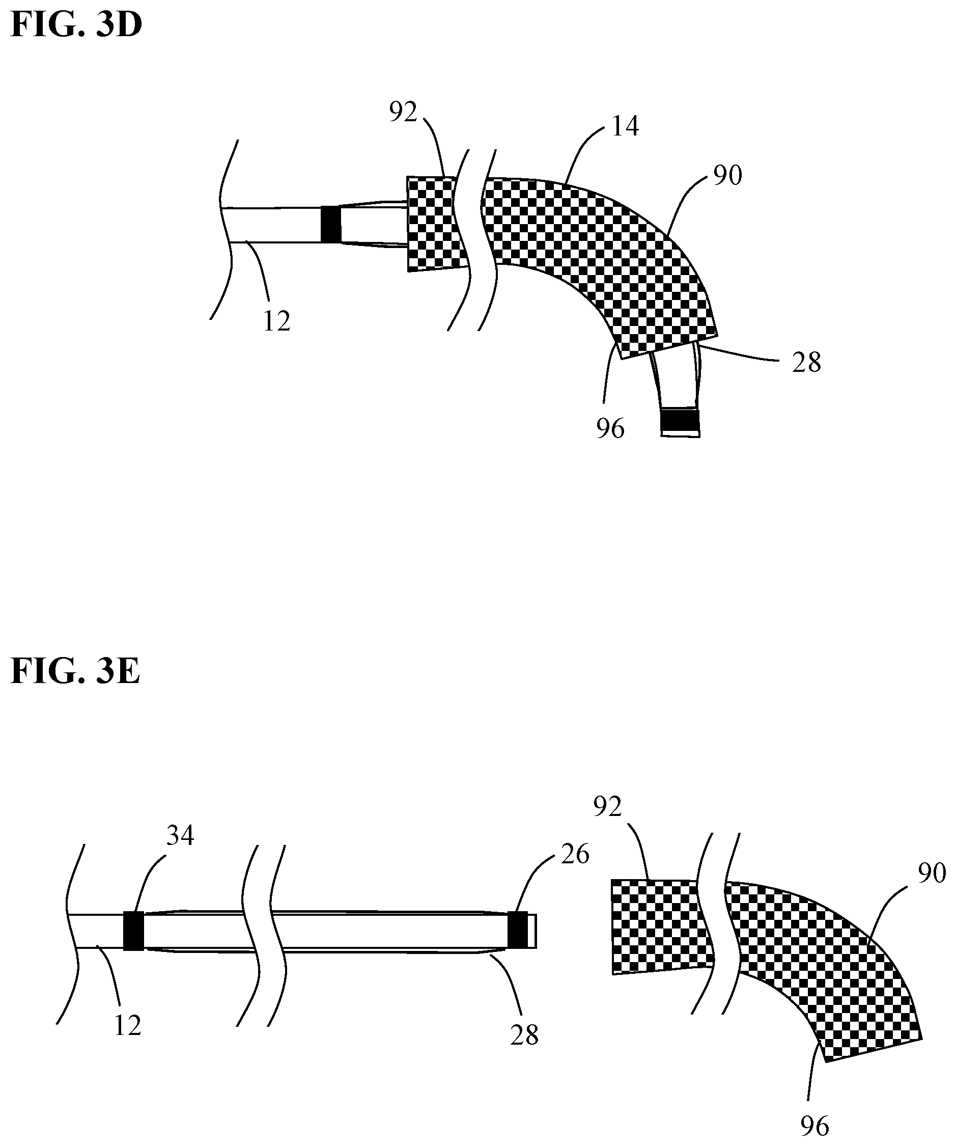 Patent US12097137 Figure 4 – Systems and methods for intravascular procedures
