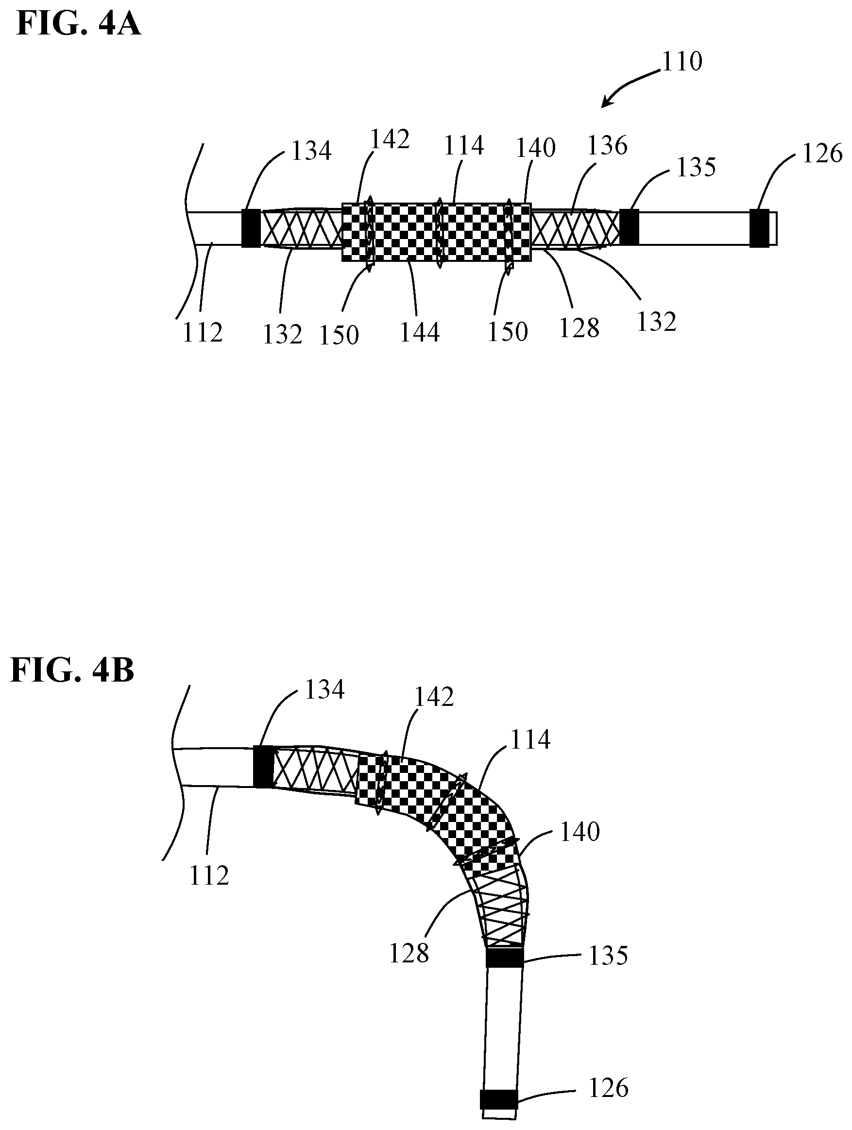 Patent US12097137 Figure 5 – Systems and methods for intravascular procedures