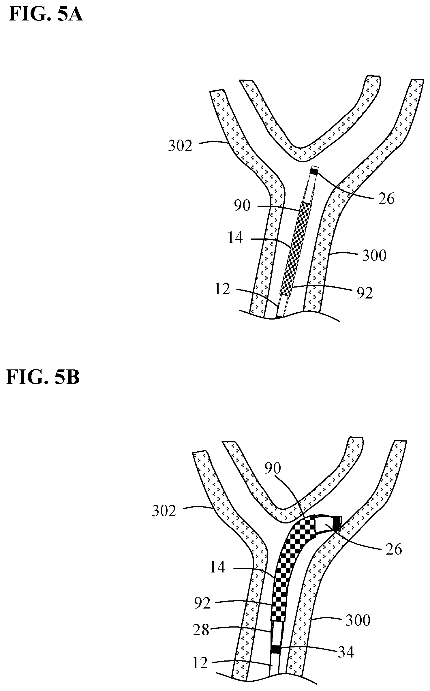 Patent US12097137 Figure 7 – Systems and methods for intravascular procedures