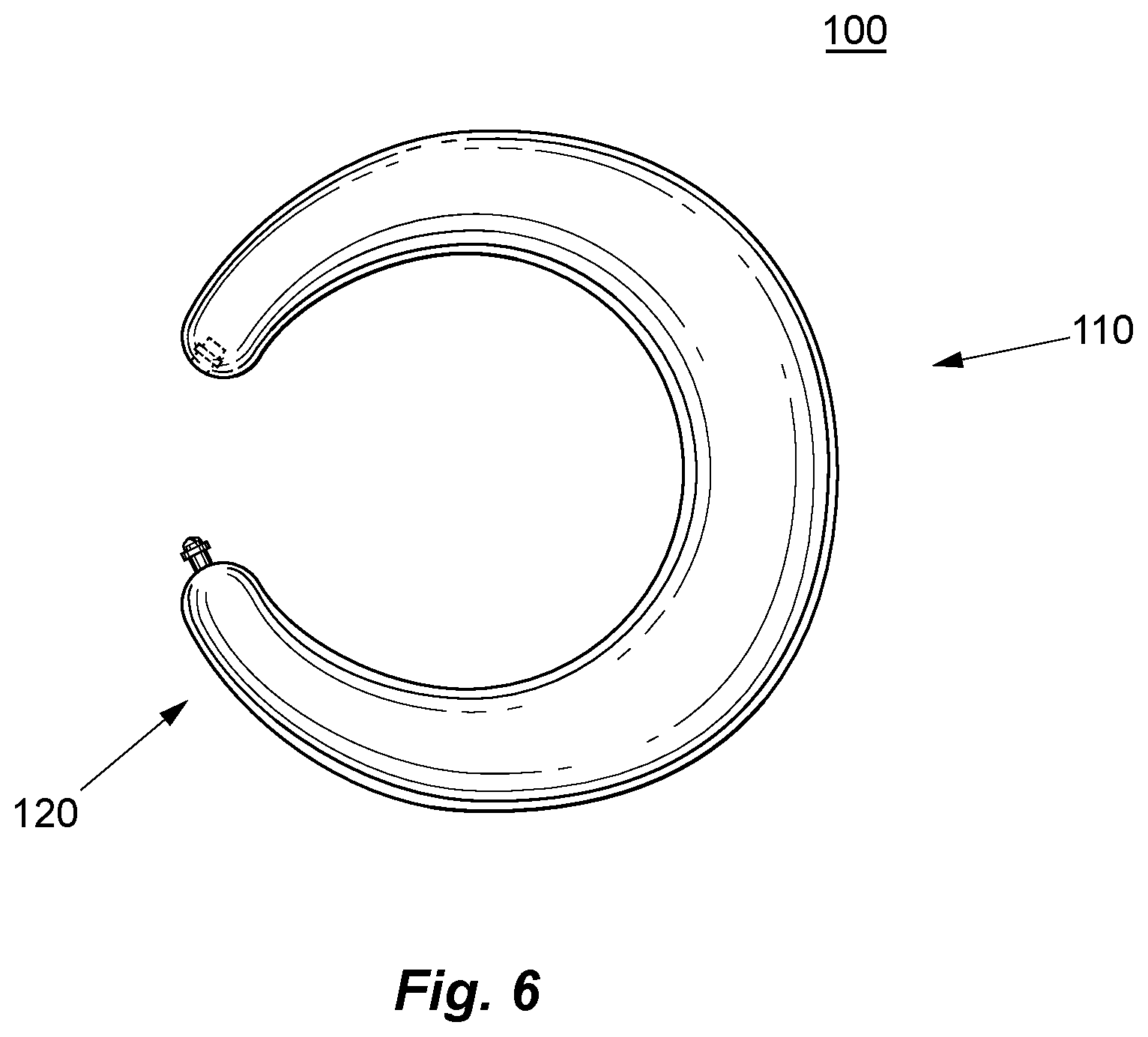 Patent US12097138 Figure 5 – Treatment of GERD