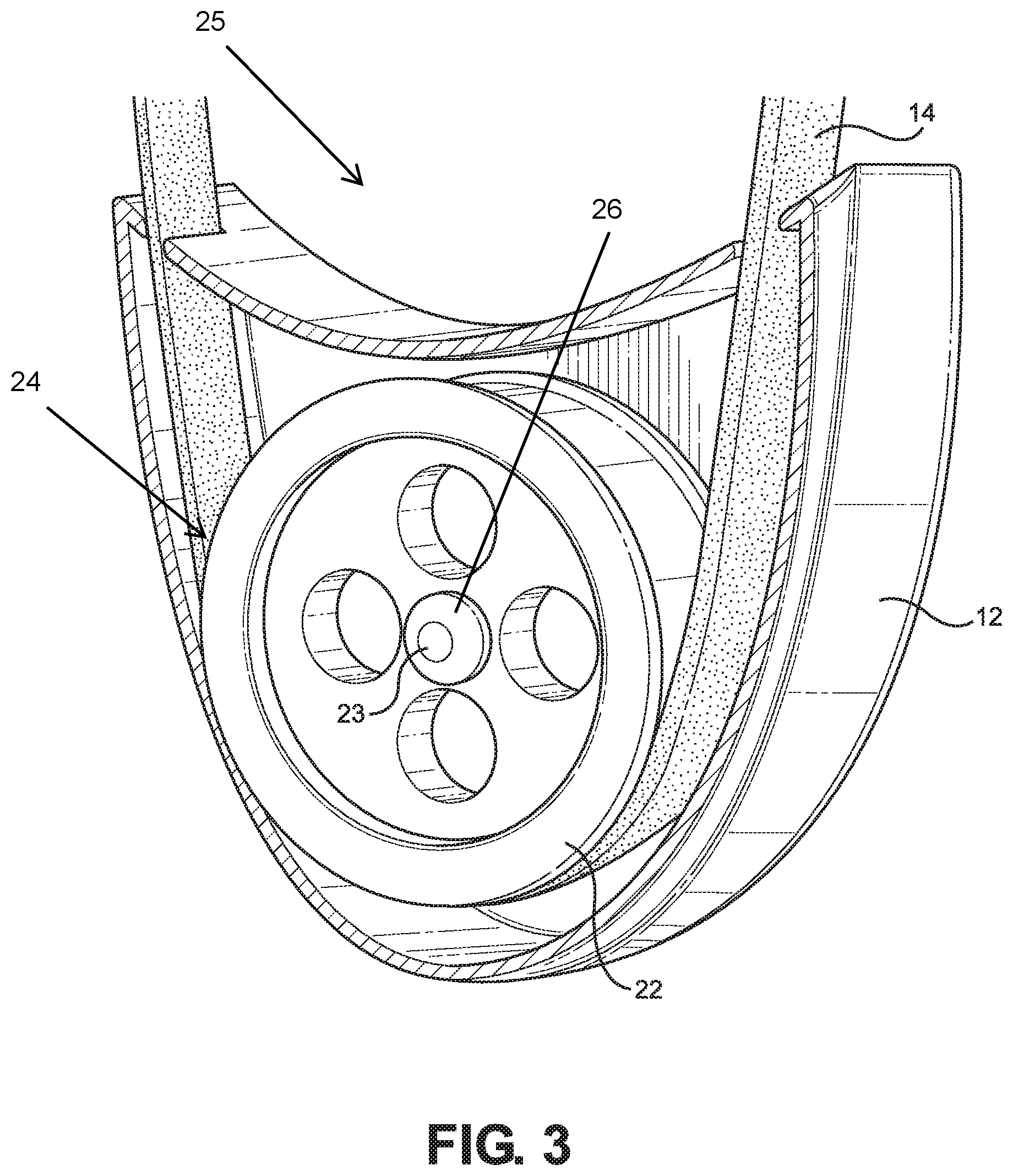 Patent US12097139 Figure 3 – Posture and lifting orthotic