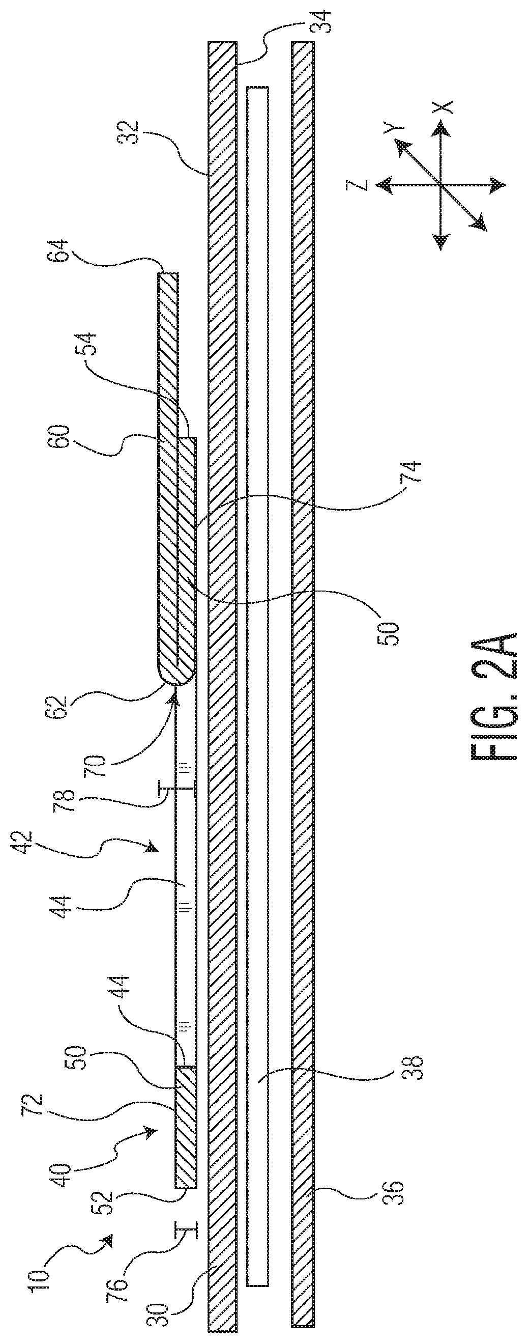 Patent US12097140 Figure 2 – Method of manufacturing an exudate management layer for use in an absorbent article