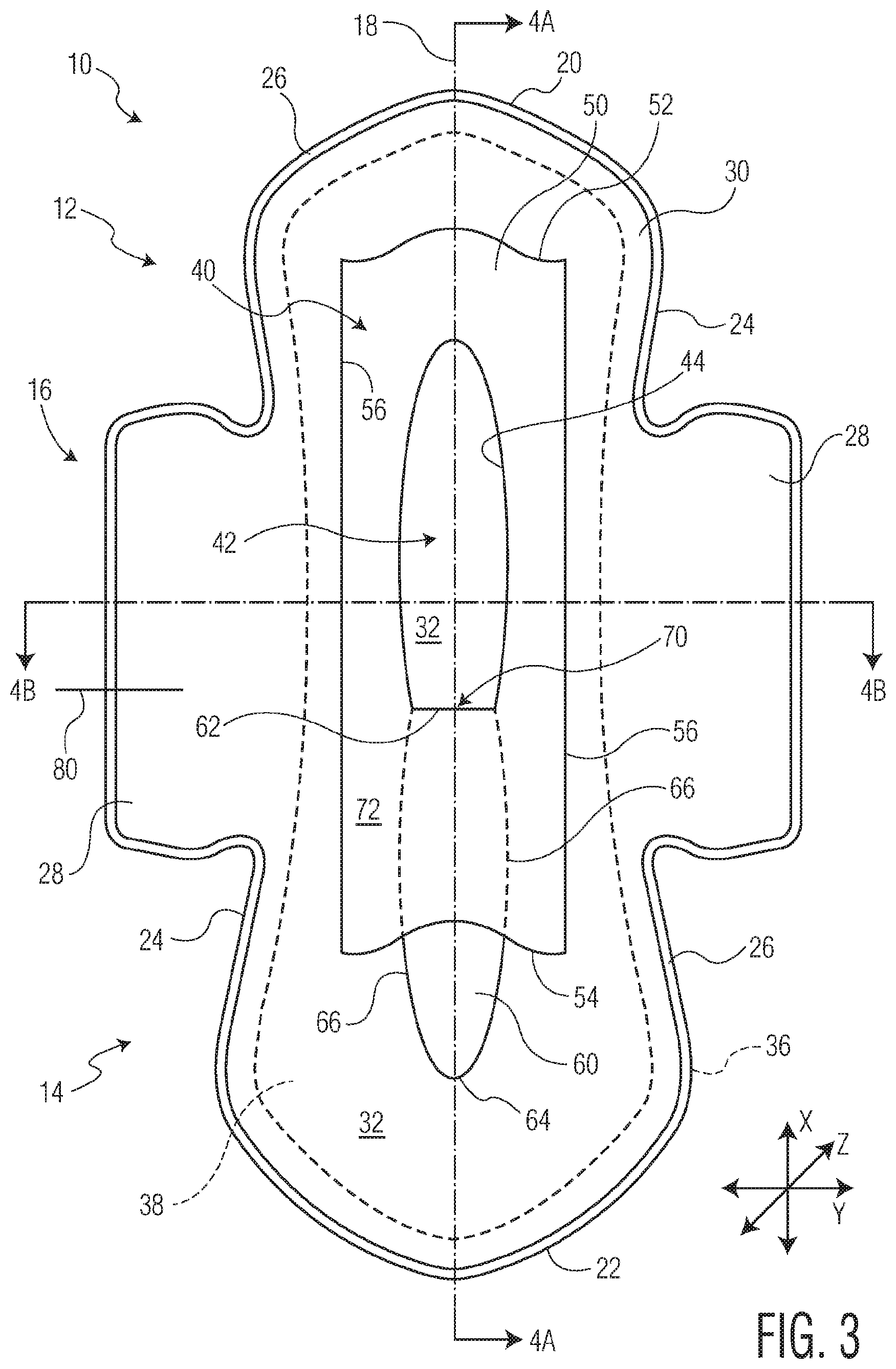 Patent US12097140 Figure 4 – Method of manufacturing an exudate management layer for use in an absorbent article
