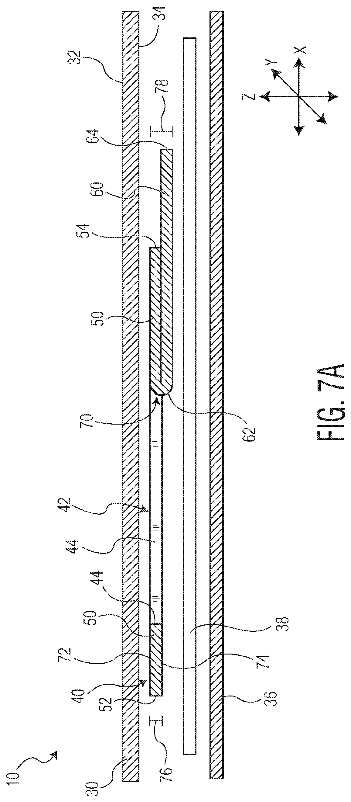 Patent US12097140 Figure 10 – Method of manufacturing an exudate management layer for use in an absorbent article
