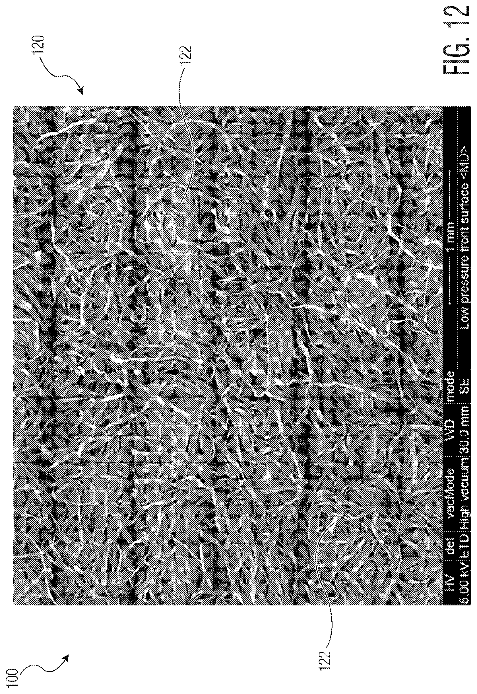 Patent US12097140 Figure 14 – Method of manufacturing an exudate management layer for use in an absorbent article