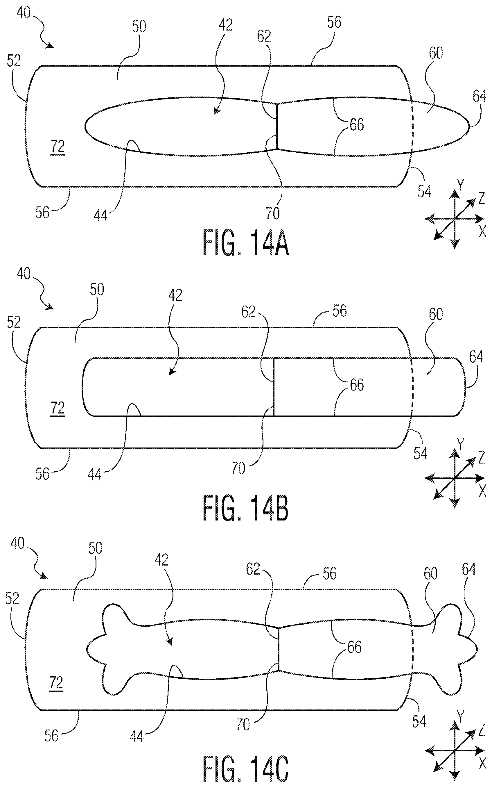 Patent US12097140 Figure 16 – Method of manufacturing an exudate management layer for use in an absorbent article