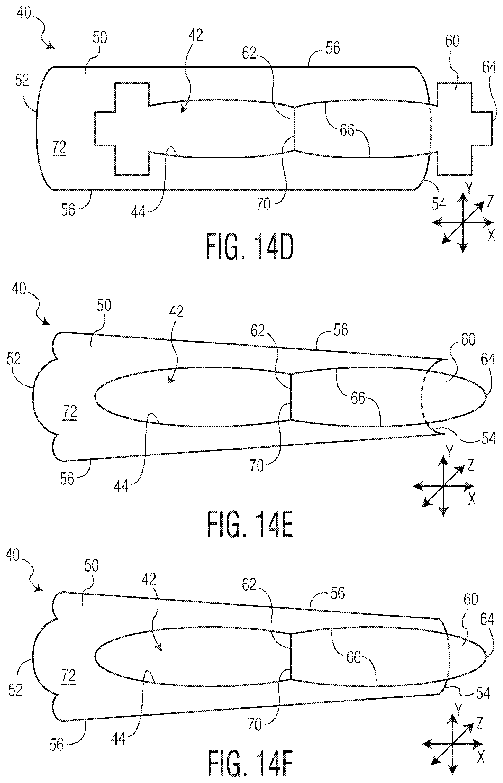 Patent US12097140 Figure 17 – Method of manufacturing an exudate management layer for use in an absorbent article