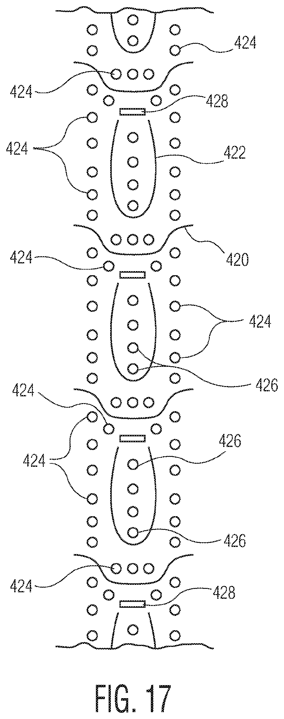 Patent US12097140 Figure 20 – Method of manufacturing an exudate management layer for use in an absorbent article
