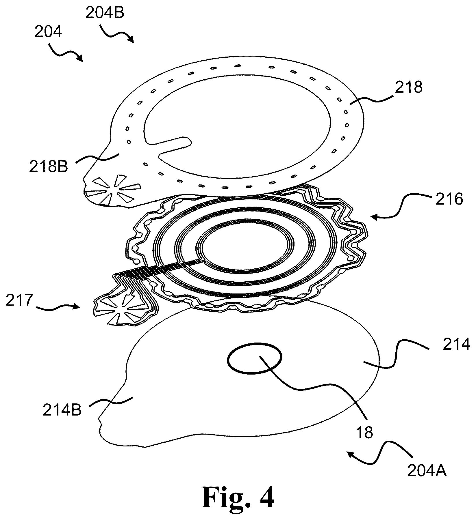 Patent US12097141 Figure 4 – Medical system having a monitor attachable to an ostomy appliance and to a docking station