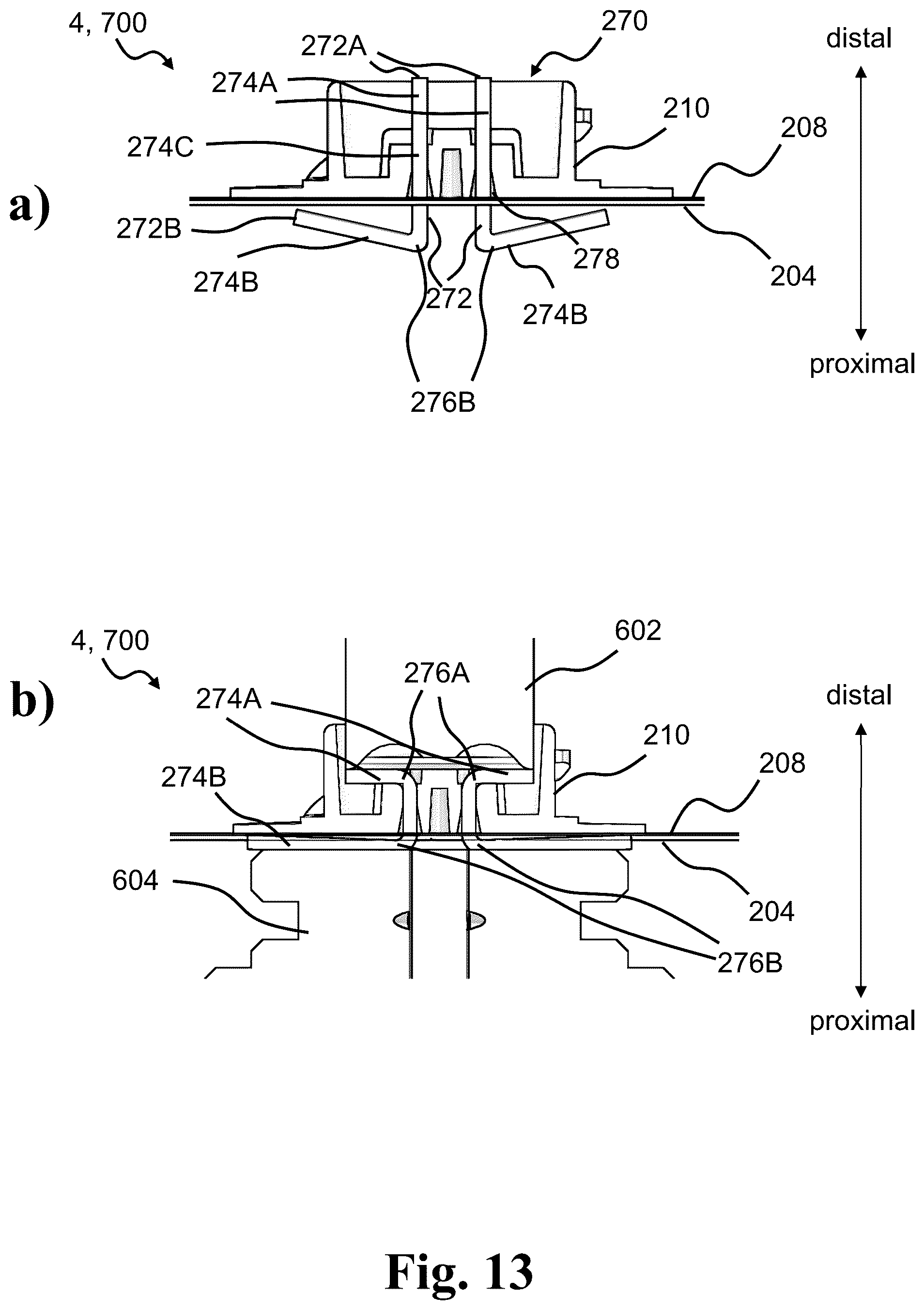 Patent US12097141 Figure 12 – Medical system having a monitor attachable to an ostomy appliance and to a docking station