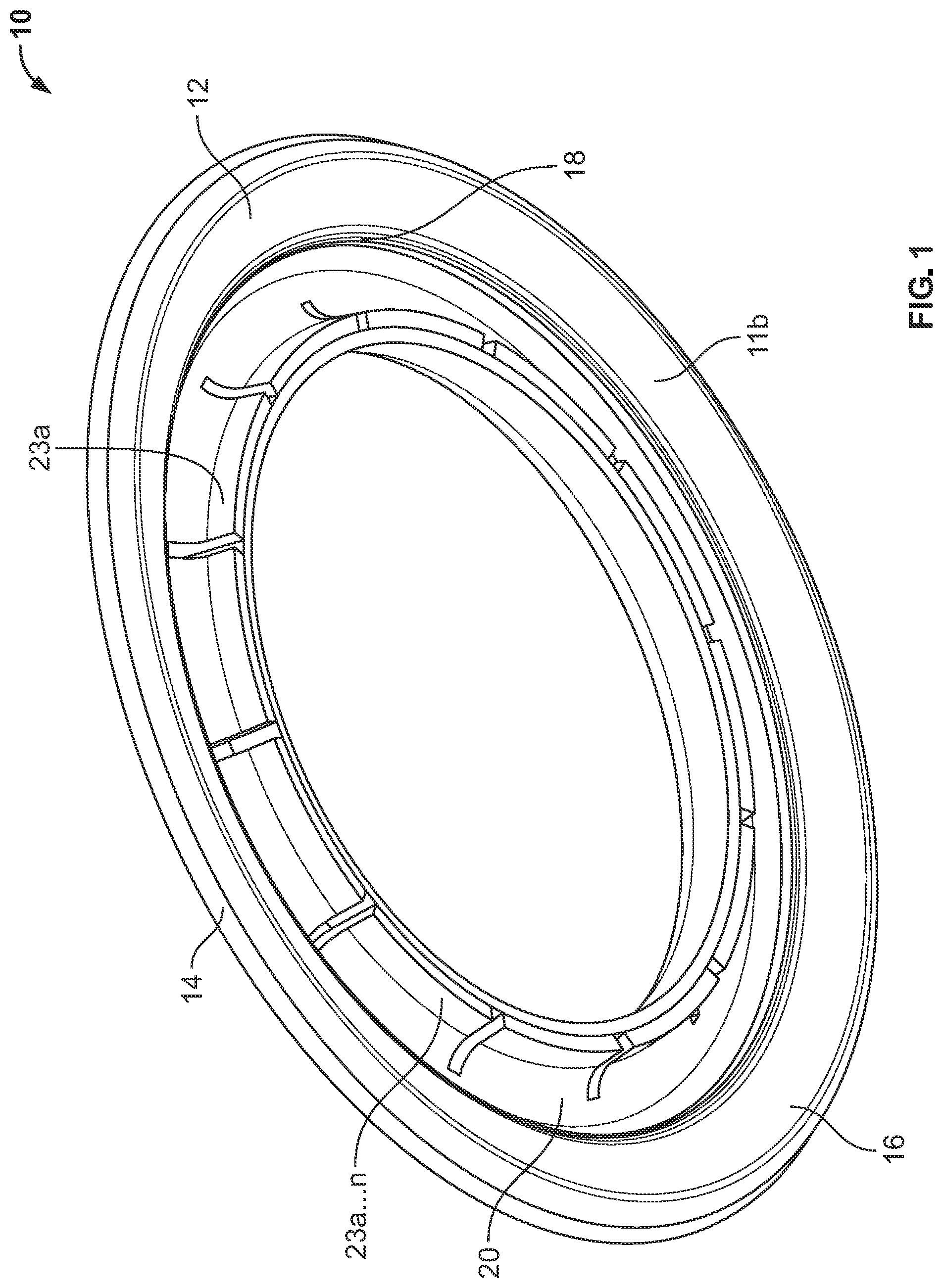 Patent US12097142 Figure 1 – Ostomy appliance with customizable barrier ring for localized convex support