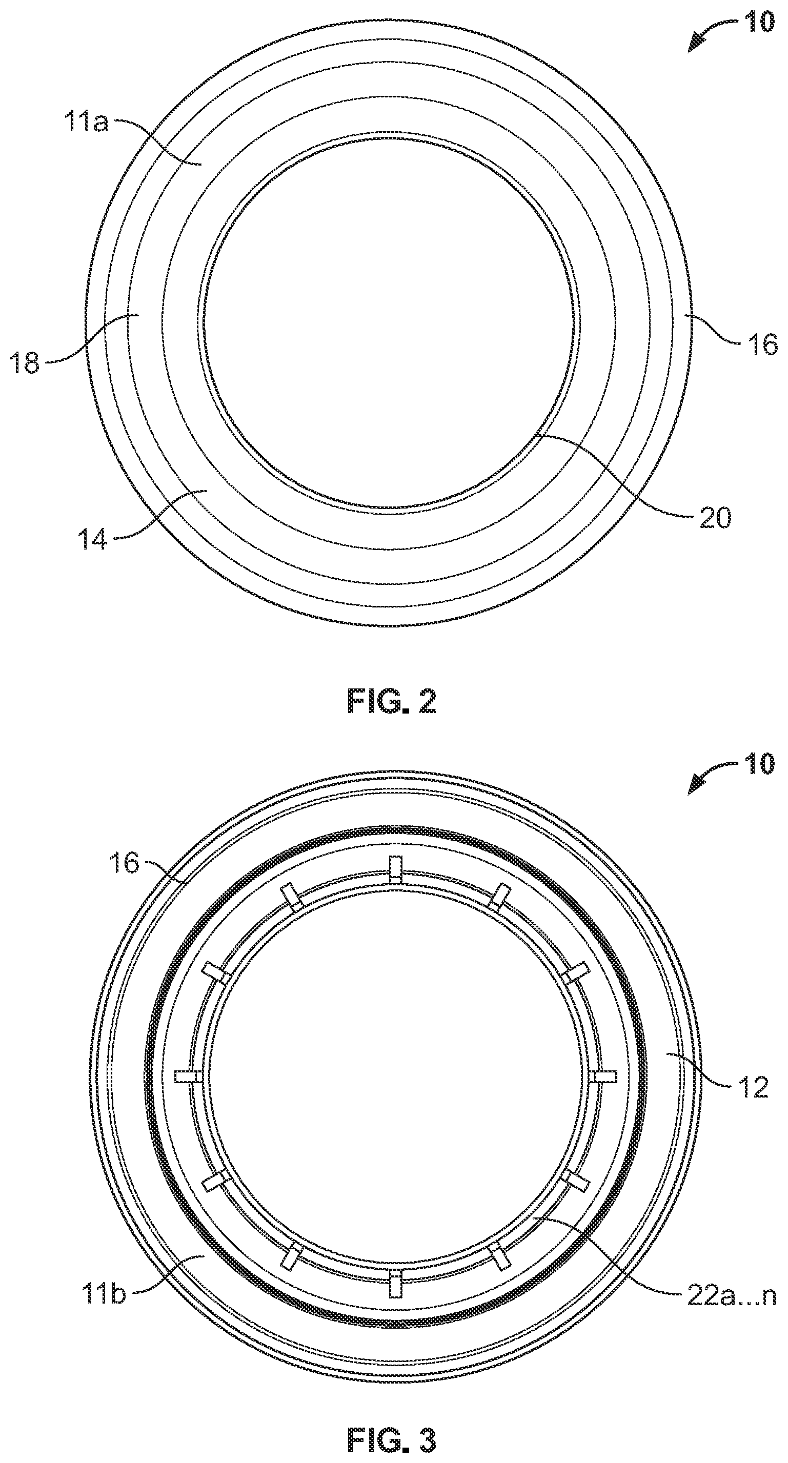 Patent US12097142 Figure 2 – Ostomy appliance with customizable barrier ring for localized convex support