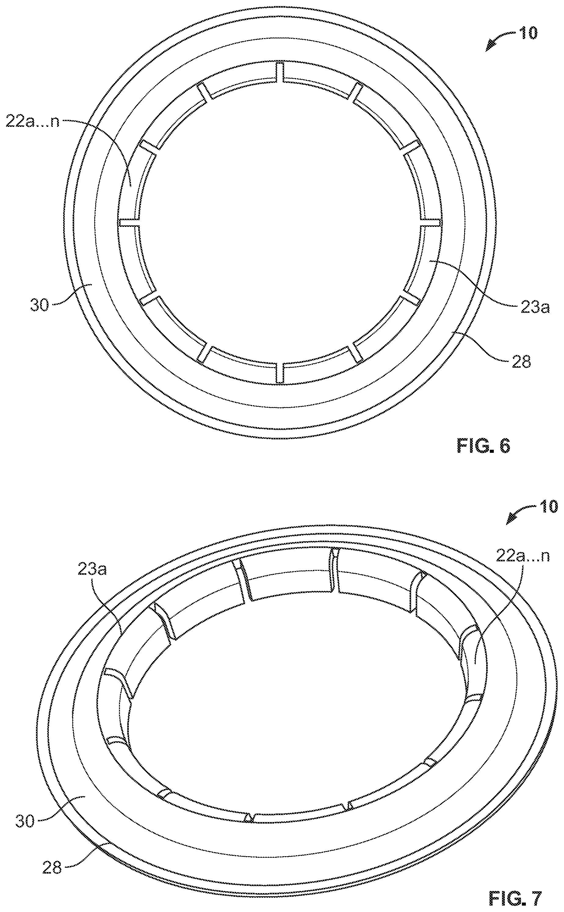 Patent US12097142 Figure 4 – Ostomy appliance with customizable barrier ring for localized convex support