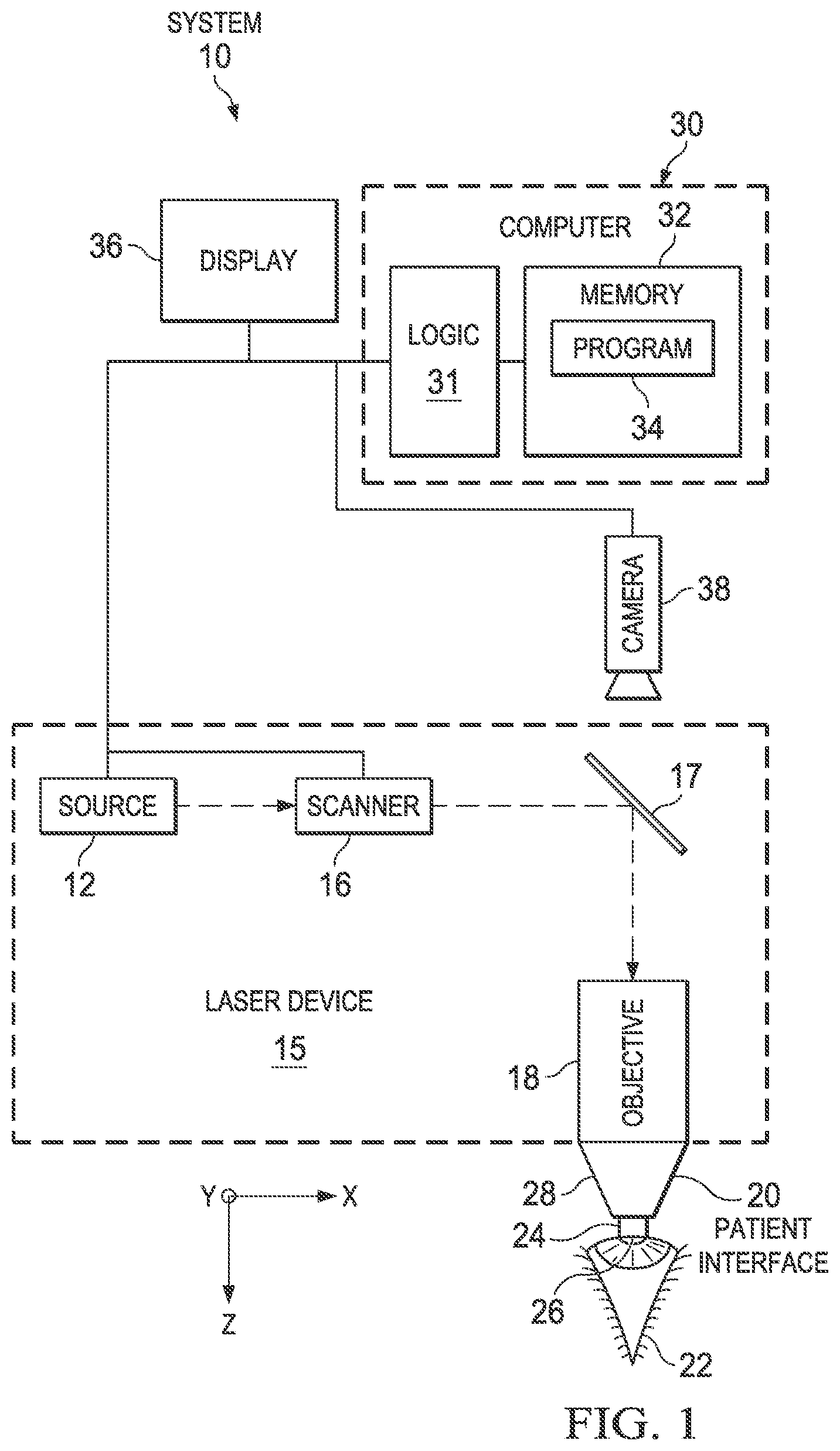 Patent US12097149 Figure 1 – Compensating for distortion of images of an eye for a surgical procedure