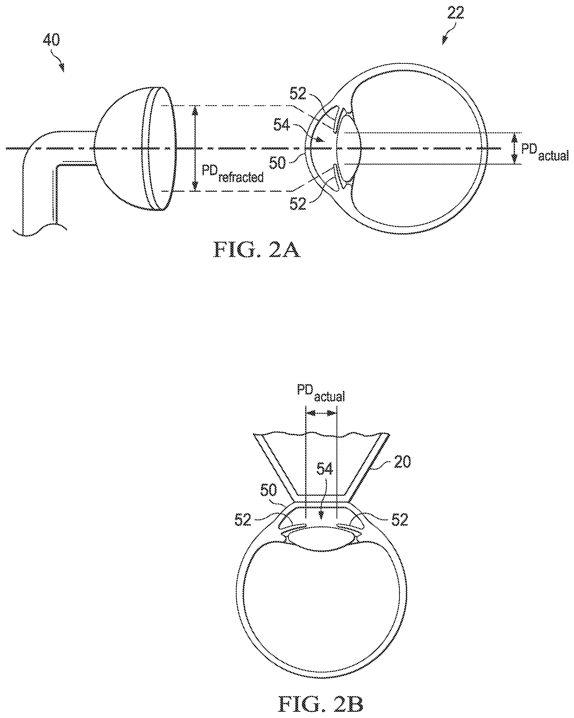 Patent US12097149 Figure 2 – Compensating for distortion of images of an eye for a surgical procedure