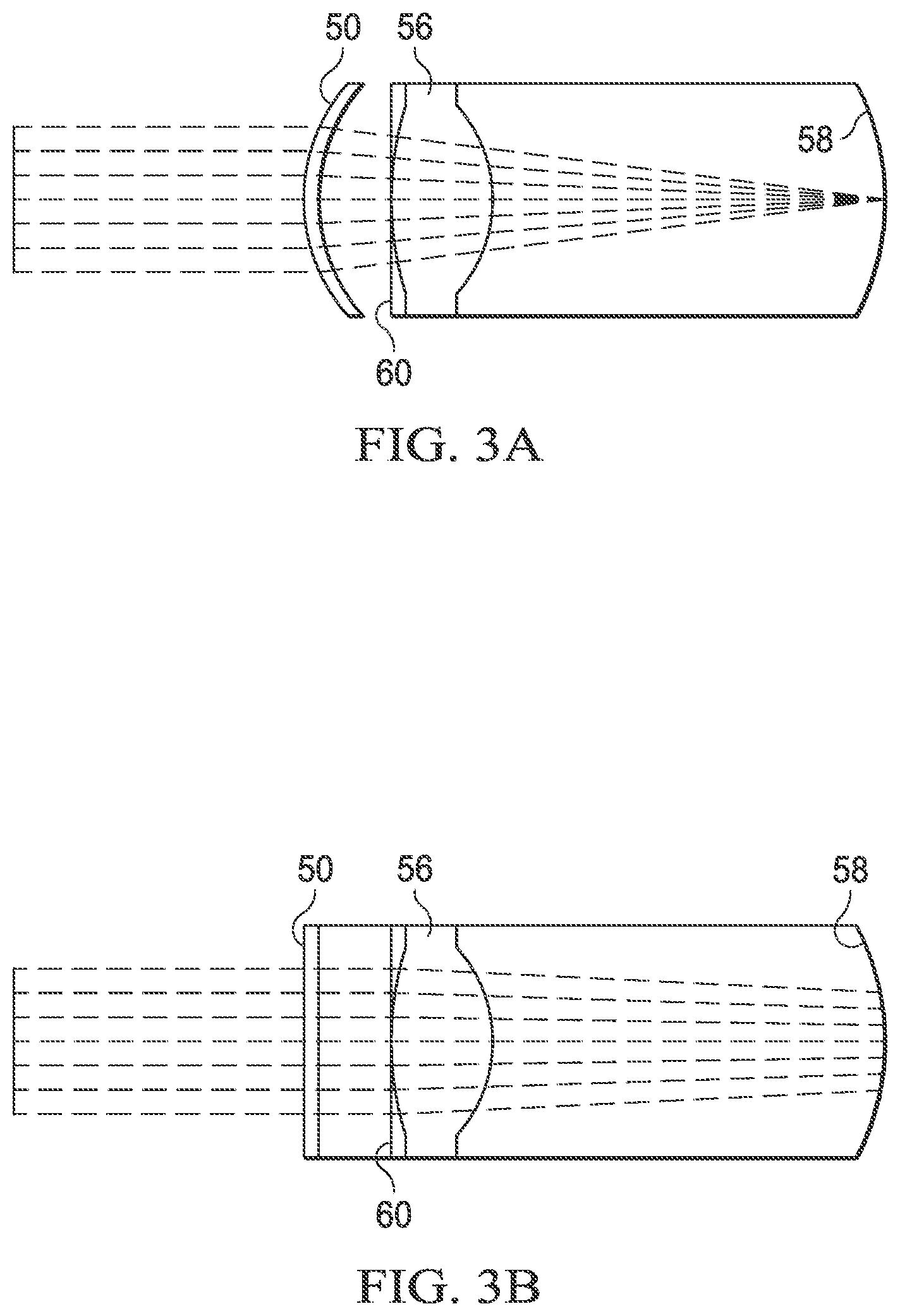Patent US12097149 Figure 3 – Compensating for distortion of images of an eye for a surgical procedure