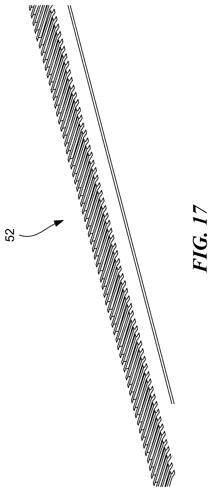 Patent US12097151 Figure 17 – Surgical table and accessories to facilitate hip arthroscopy