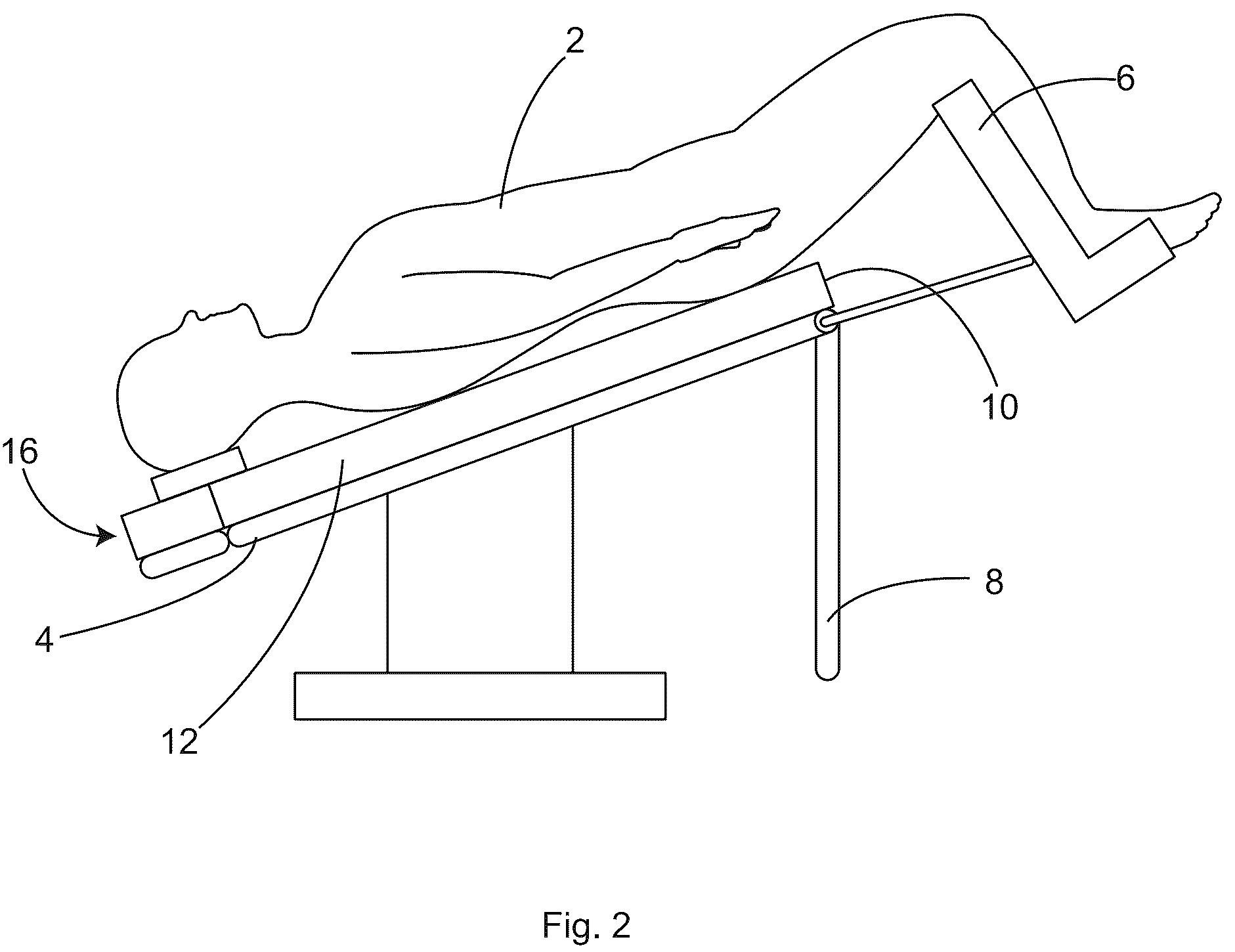Patent US12097152 Figure 2 – Patient securement system for the surgical Trendelenburg position
