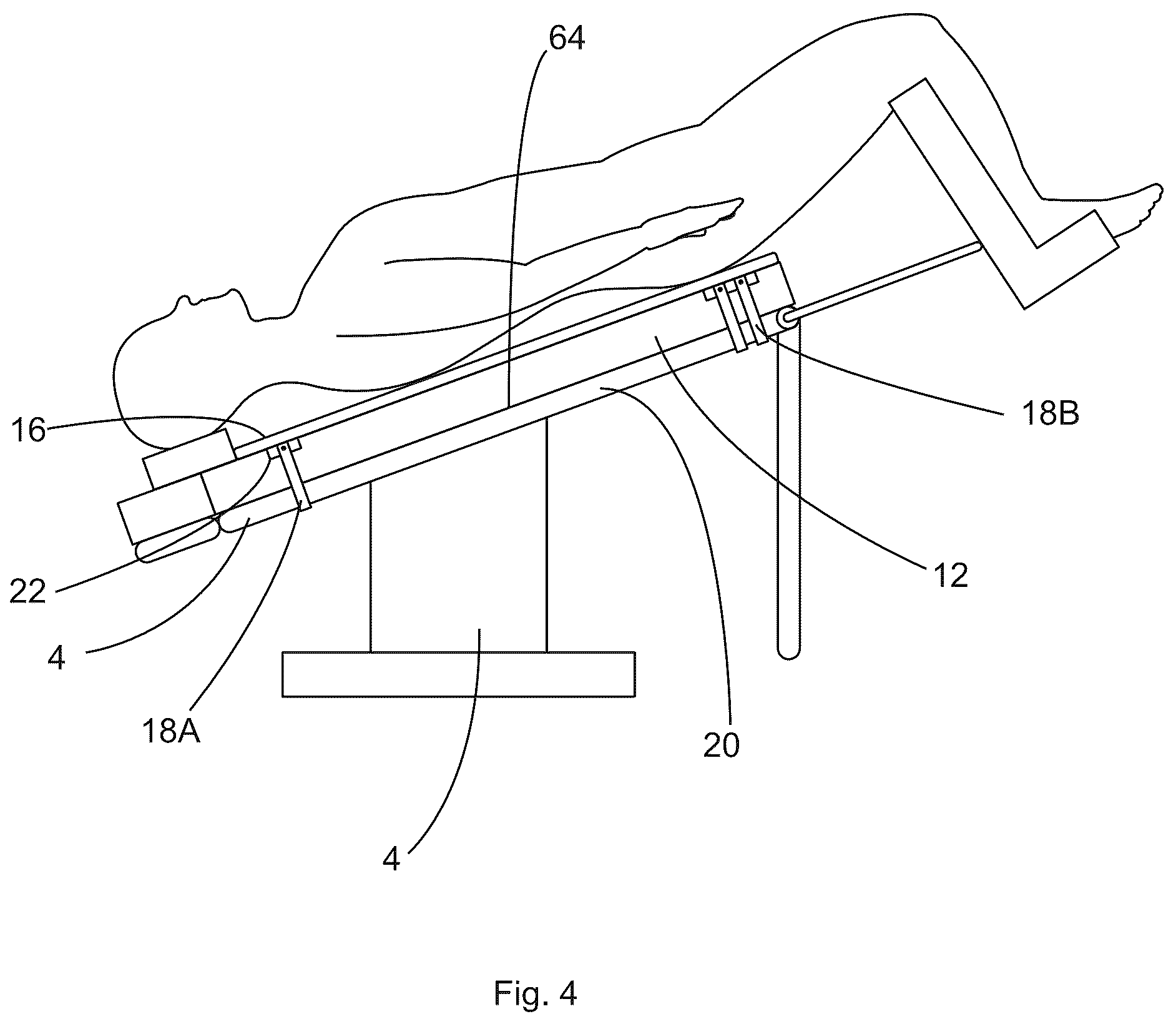 Patent US12097152 Figure 4 – Patient securement system for the surgical Trendelenburg position