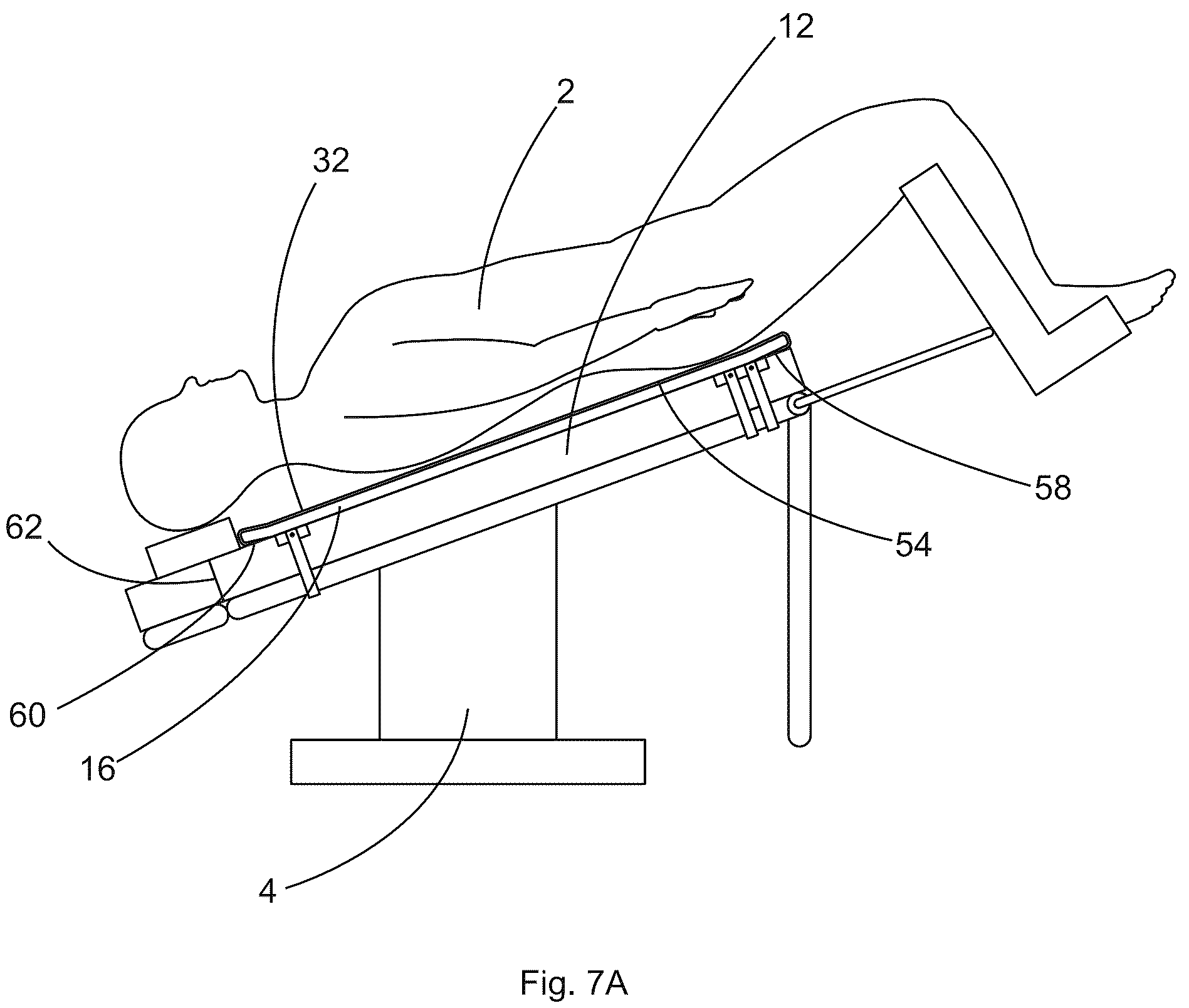 Patent US12097152 Figure 7 – Patient securement system for the surgical Trendelenburg position