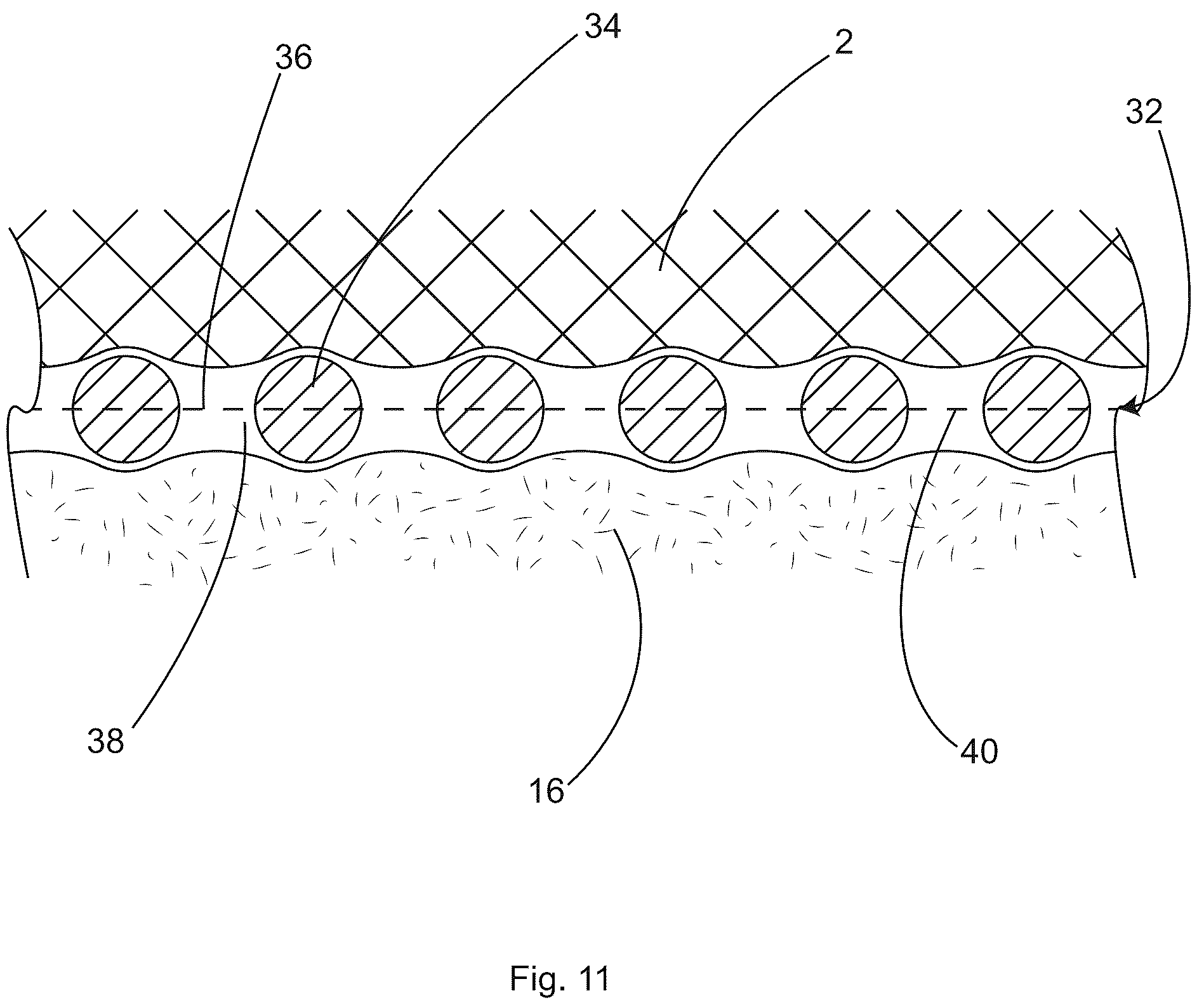 Patent US12097152 Figure 11 – Patient securement system for the surgical Trendelenburg position