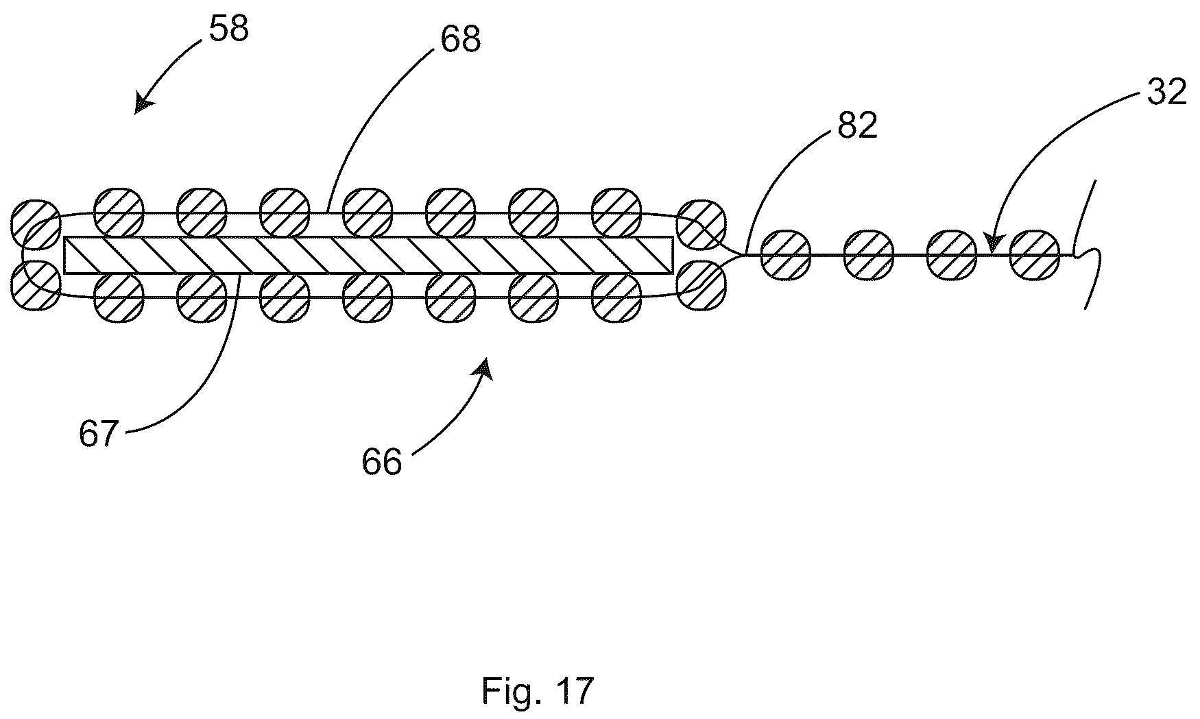 Patent US12097152 Figure 15 – Patient securement system for the surgical Trendelenburg position