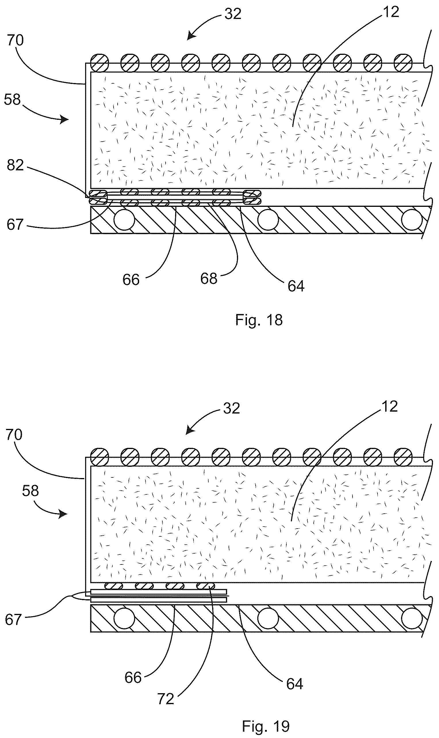 Patent US12097152 Figure 16 – Patient securement system for the surgical Trendelenburg position