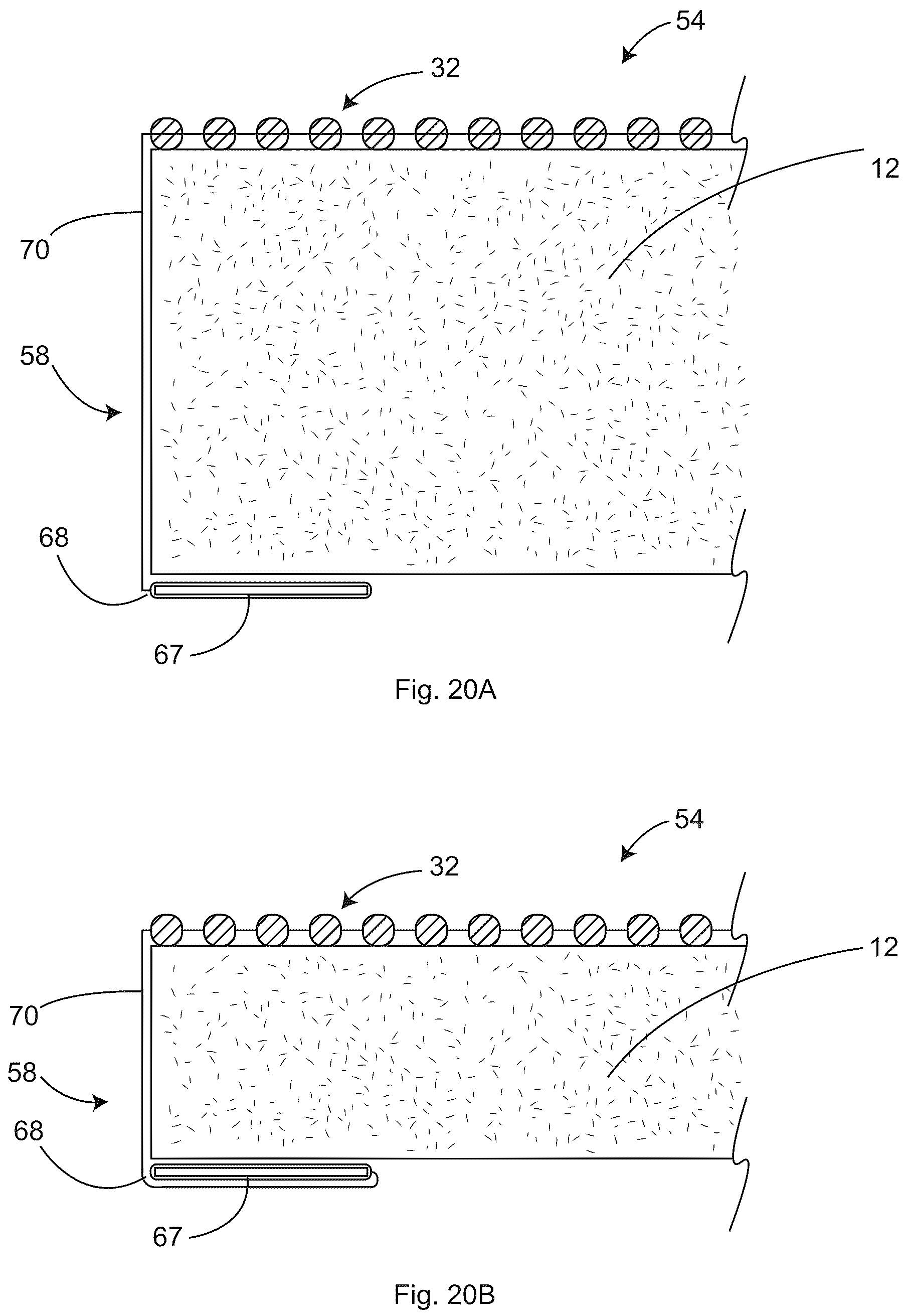 Patent US12097152 Figure 17 – Patient securement system for the surgical Trendelenburg position