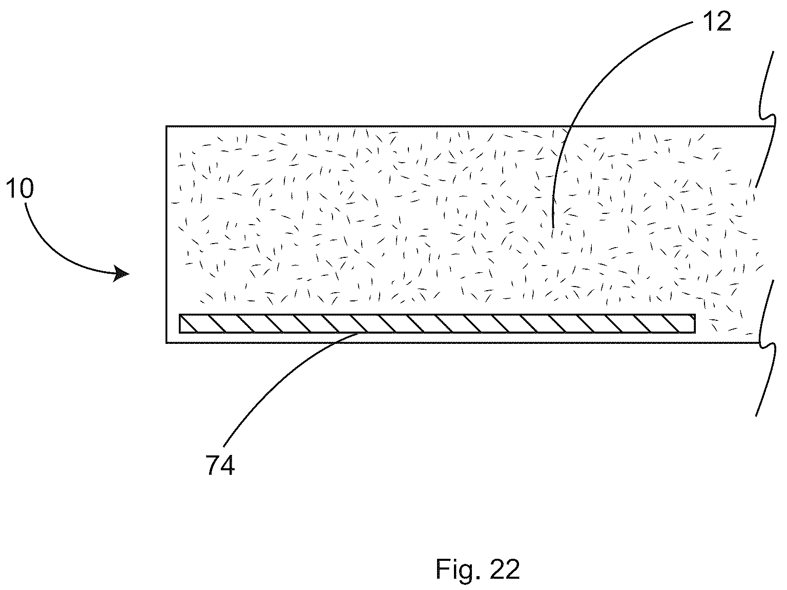 Patent US12097152 Figure 20 – Patient securement system for the surgical Trendelenburg position