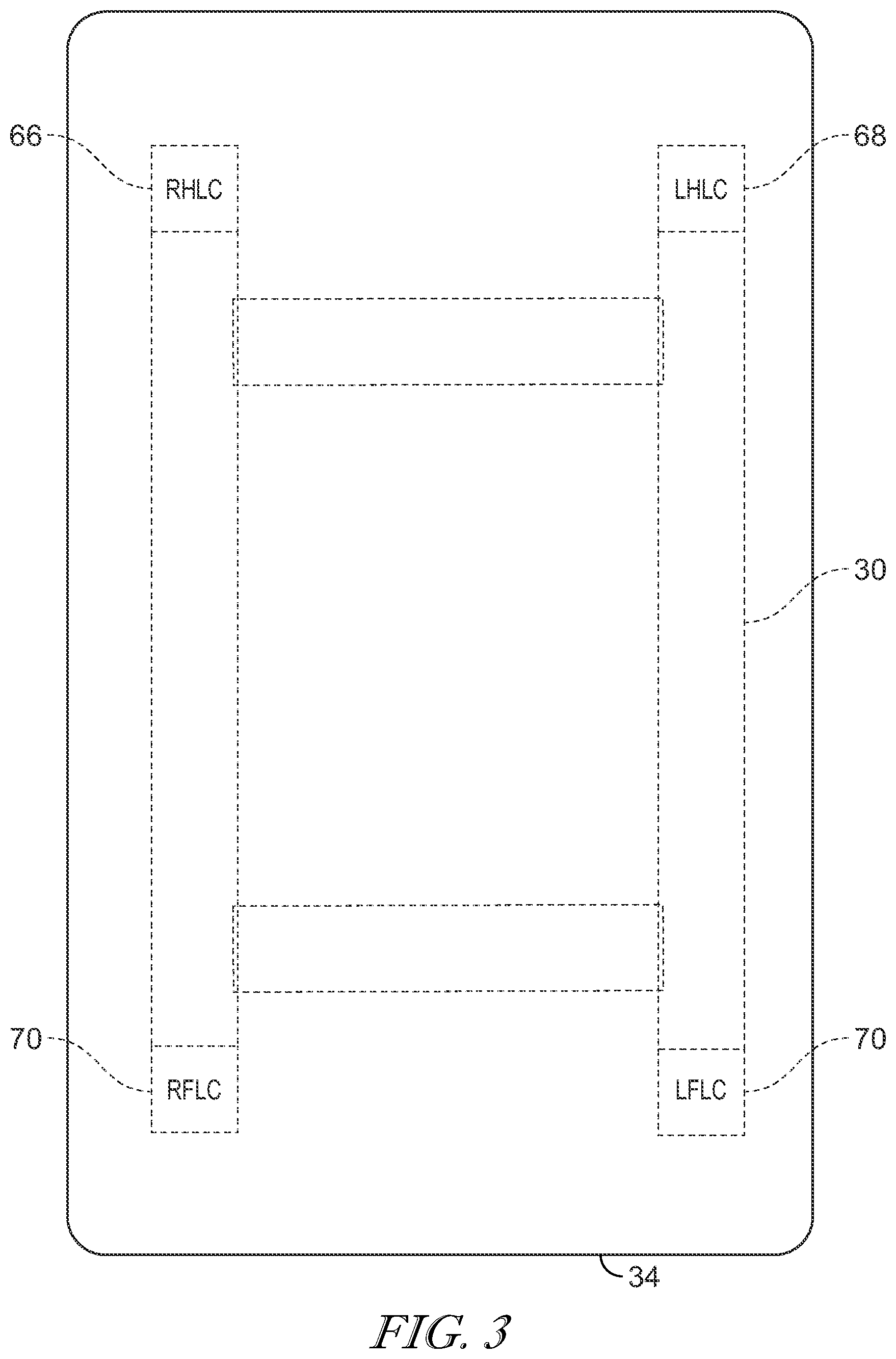 Patent US12097154 Figure 3 – Universal load cell features that characterize patient motion in three dimensions in a hospital bed