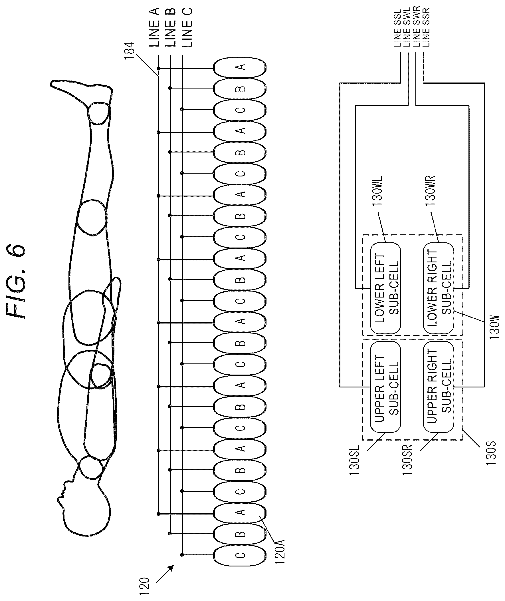Patent US12097155 Figure 6 – Mattress, sensor system