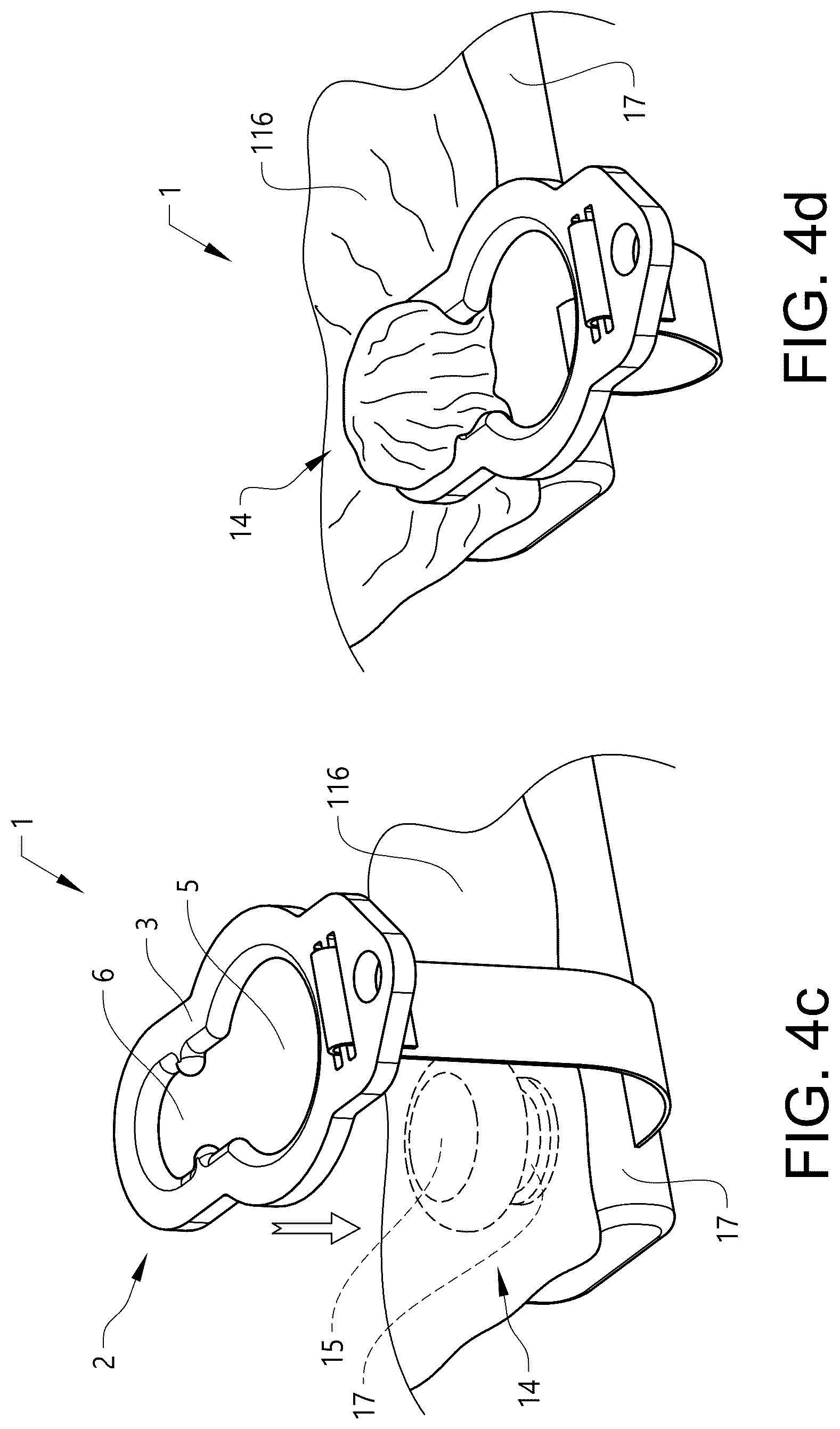 Patent US12097156 Figure 4 – Sheet holding arrangement and a patient transfer device