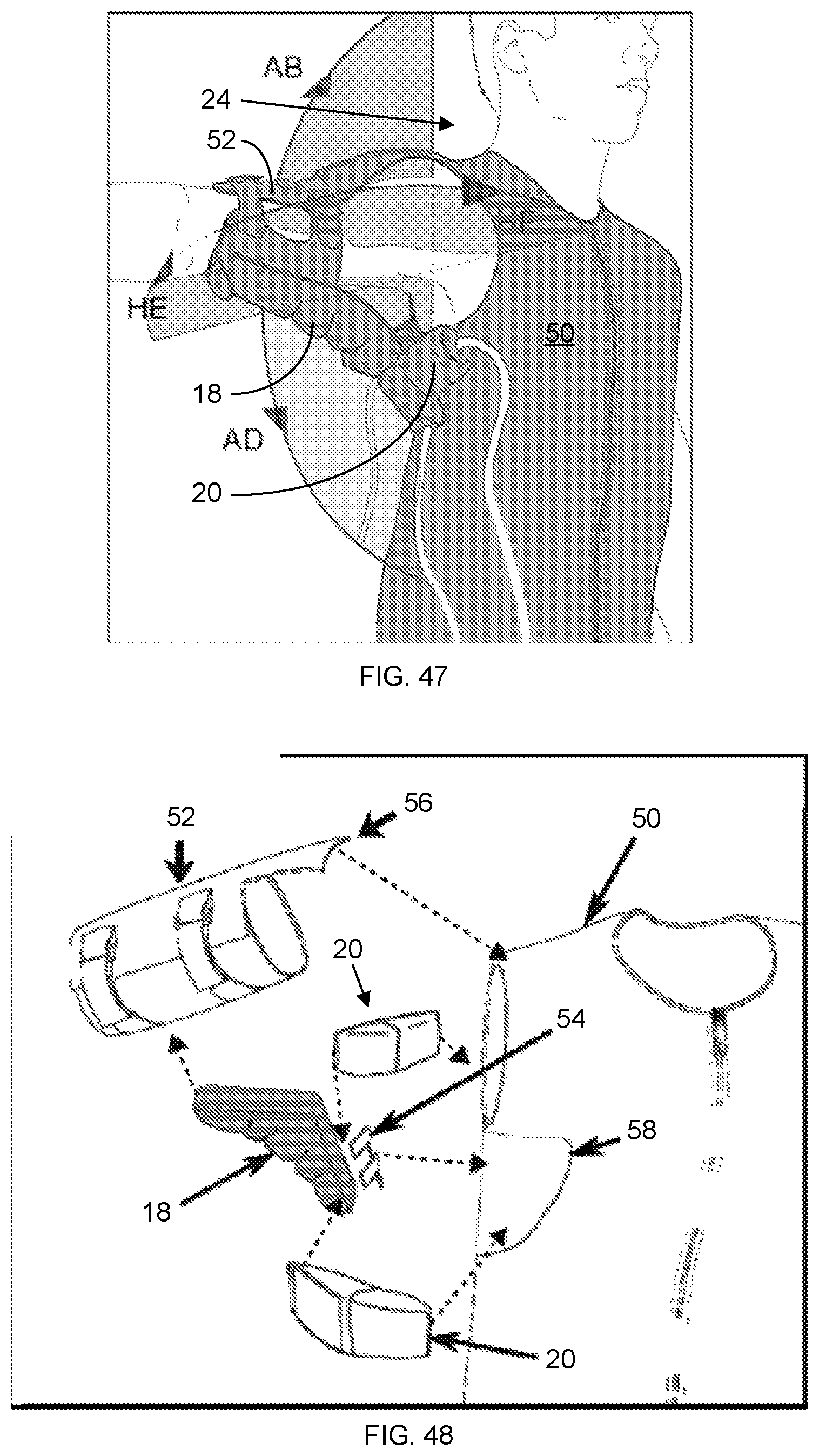 Patent US12097159 Figure 14 – Textile actuators