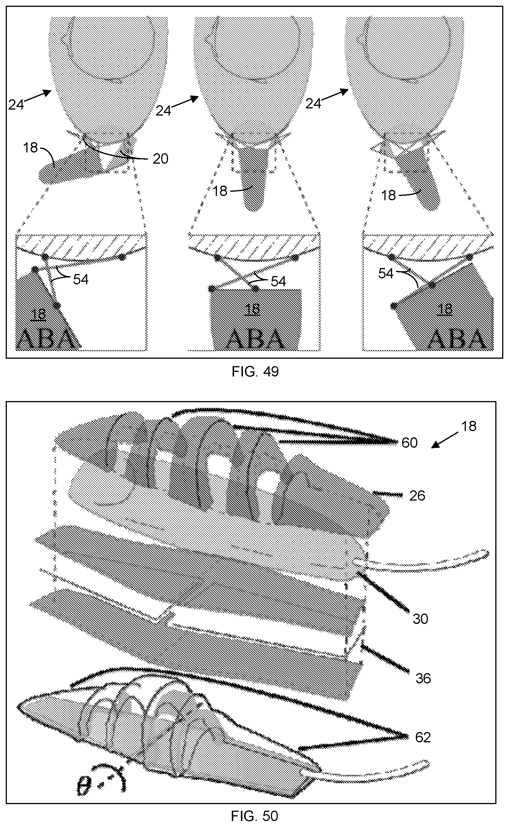 Patent US12097159 Figure 15 – Textile actuators