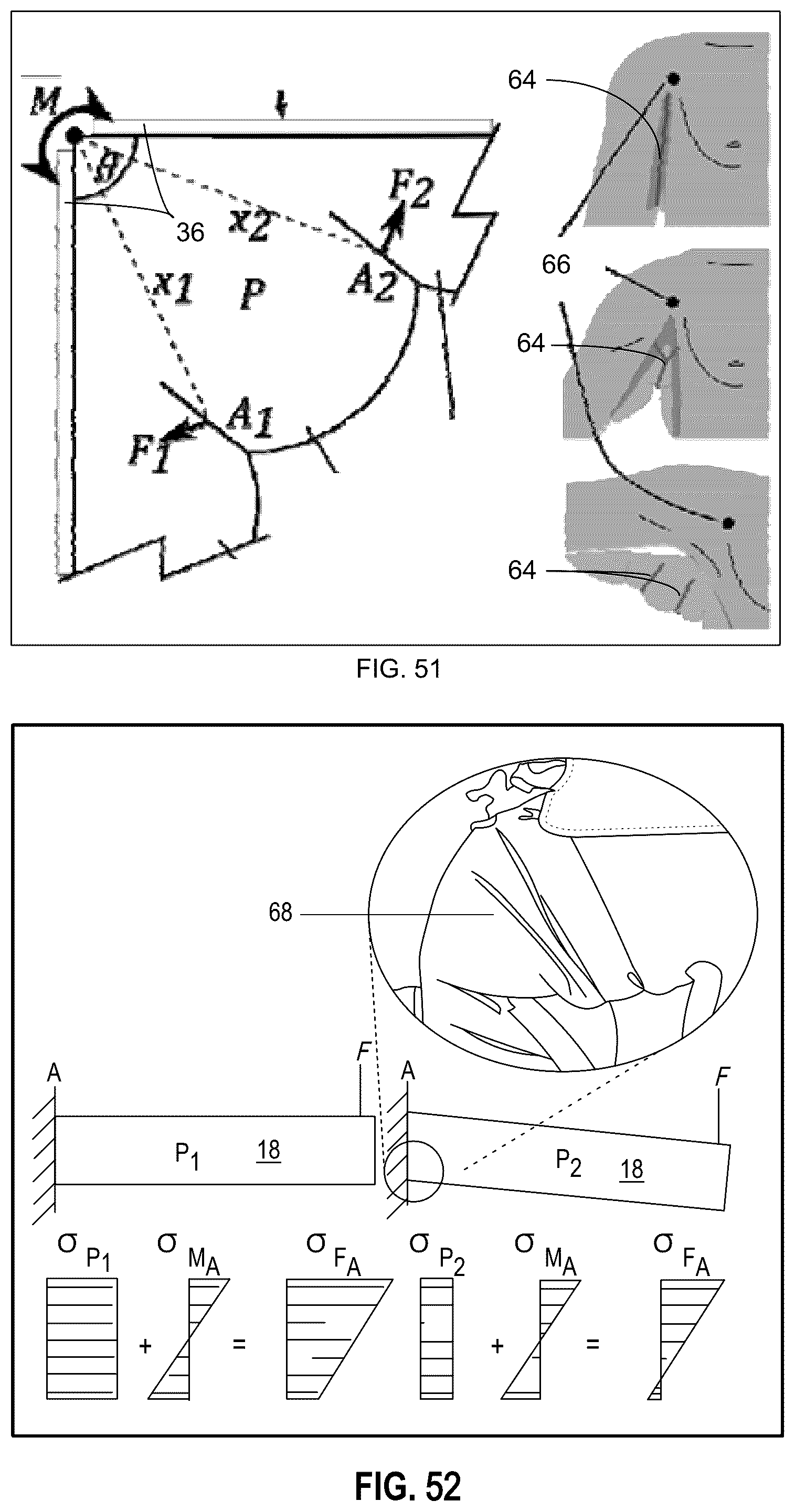 Patent US12097159 Figure 16 – Textile actuators