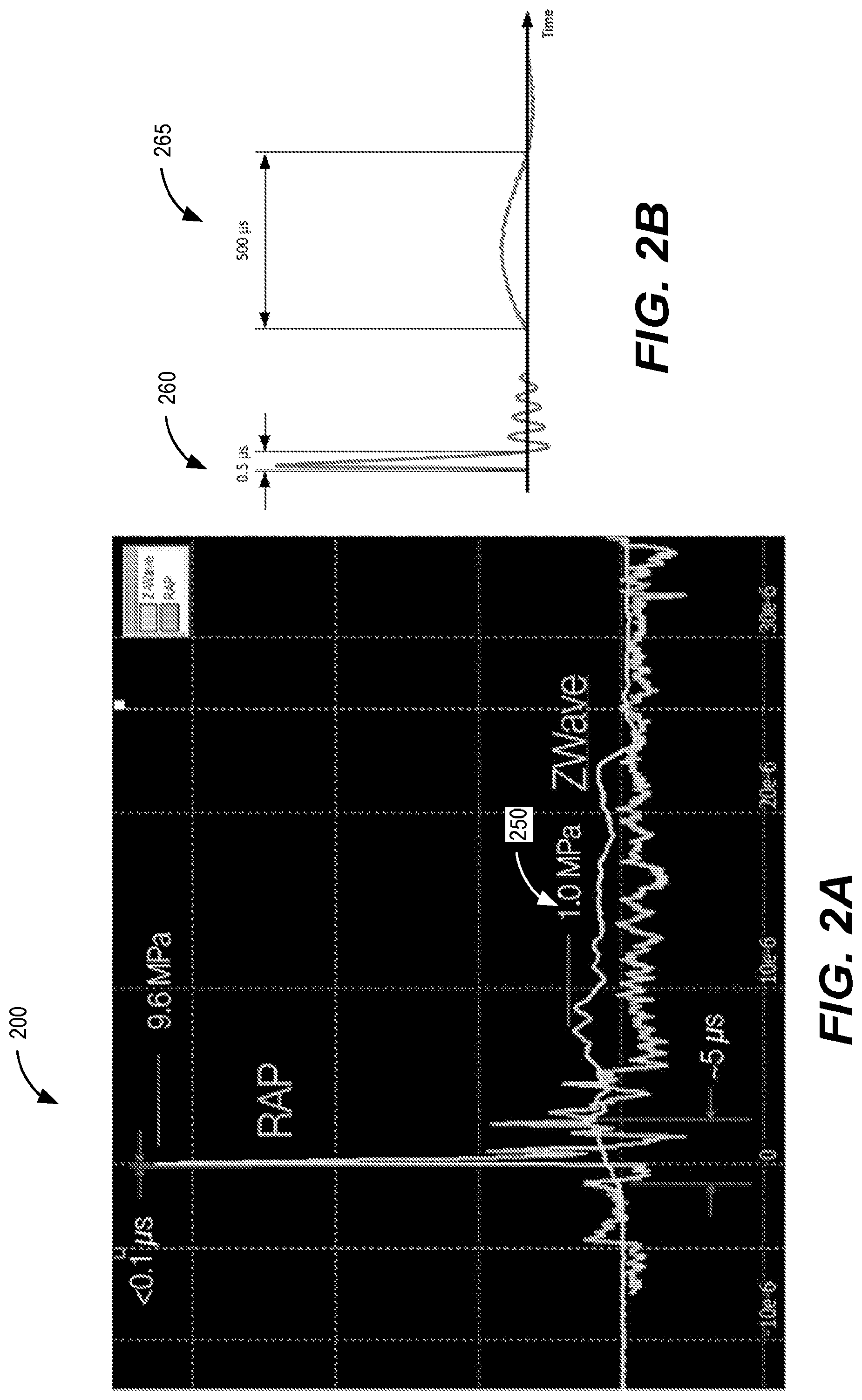Patent US12097162 Figure 2 – Systems, devices, and methods of treating tissue and cellulite by non-invasive acoustic subcision