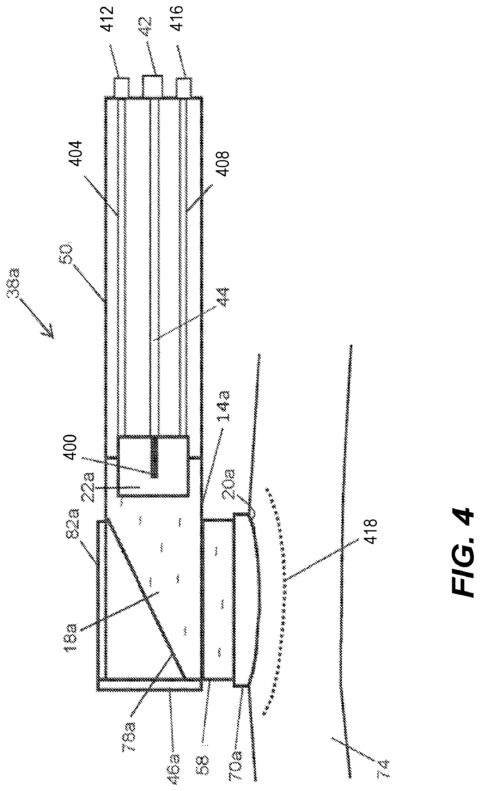 Patent US12097162 Figure 7 – Systems, devices, and methods of treating tissue and cellulite by non-invasive acoustic subcision